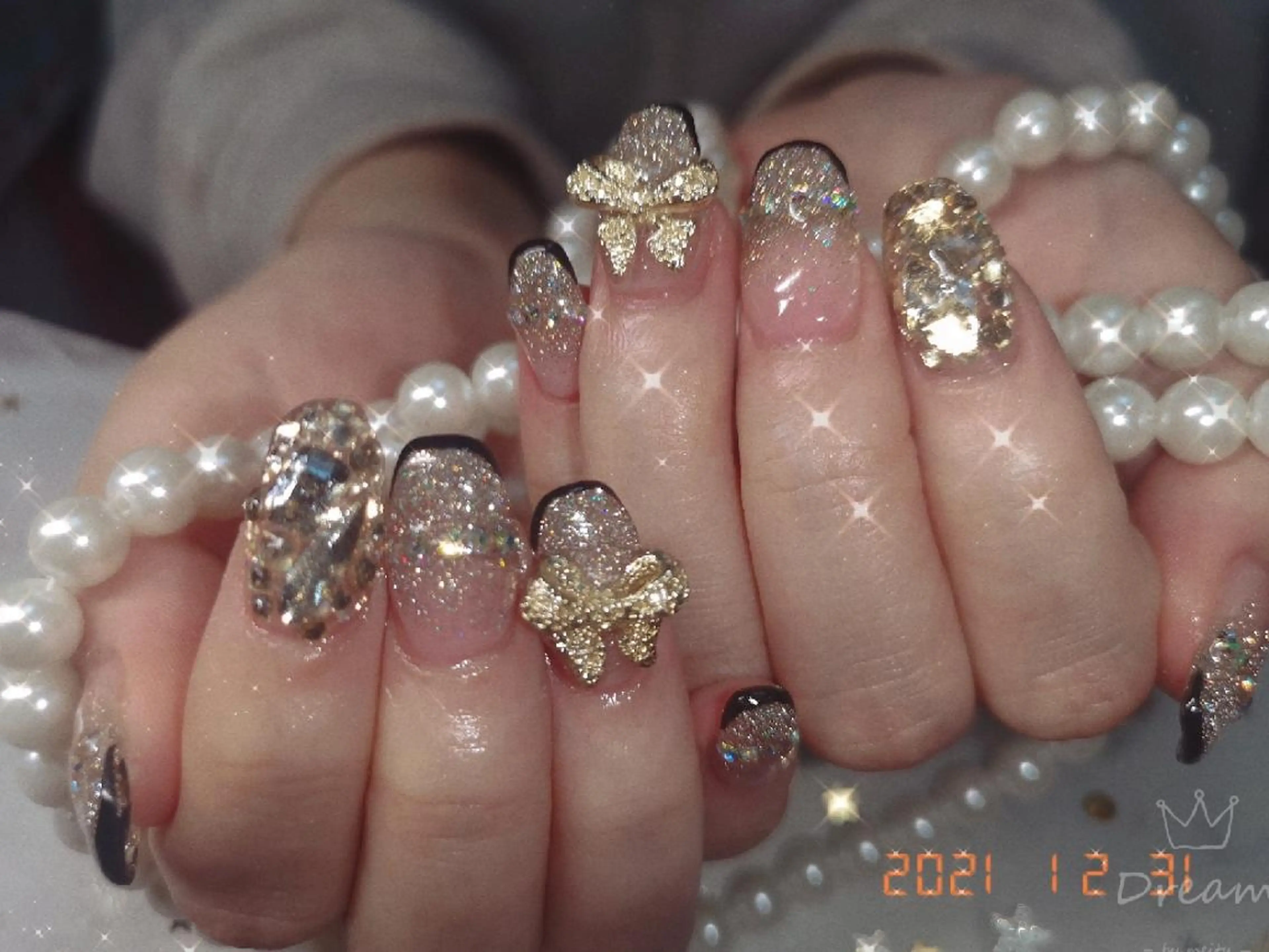 セミロング ネイル ネイリストゆか💅 長さだし、深爪矯正のネイルデザイン