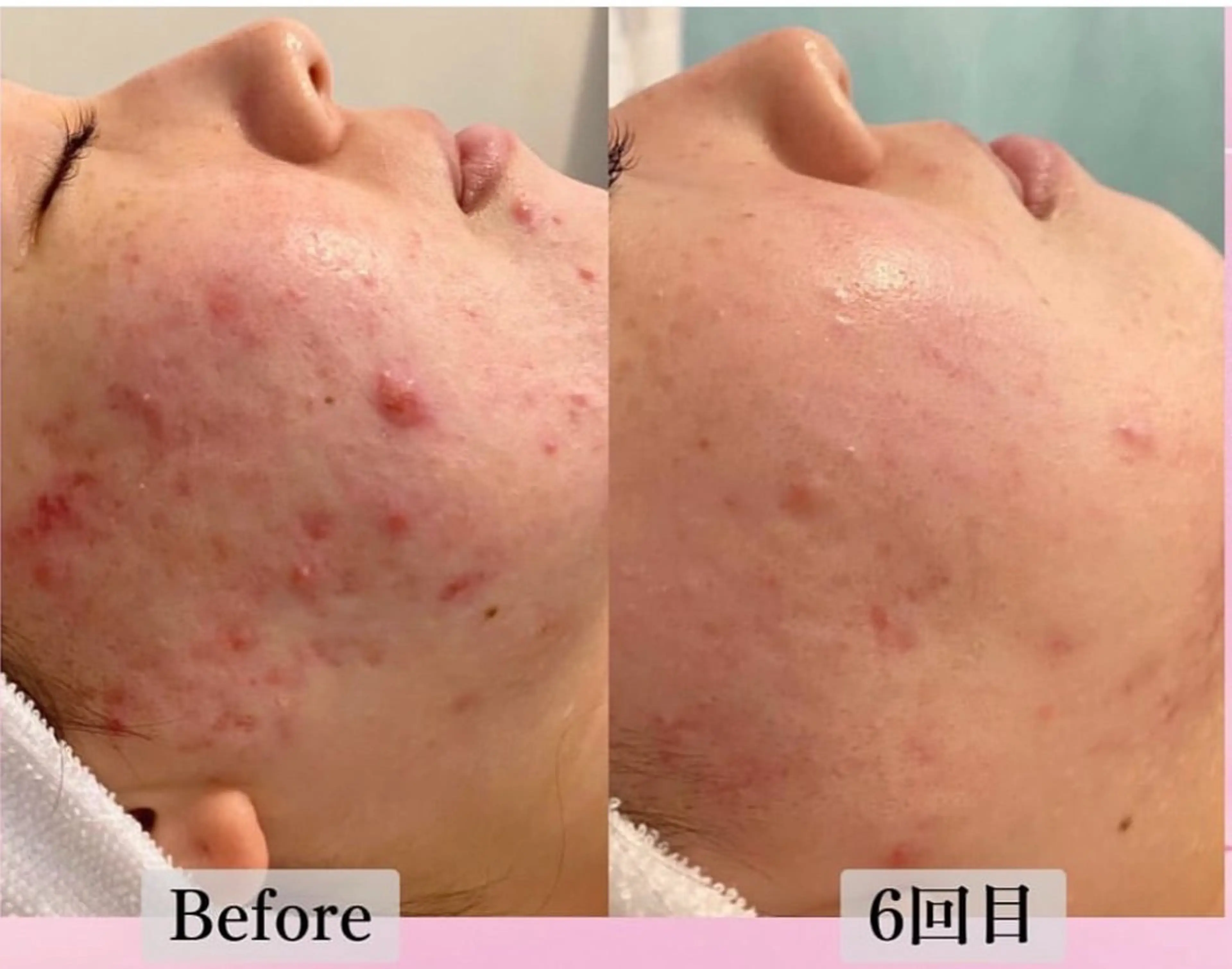 Belle原宿所属・佐藤 加奈のエステ・リラクイメージ