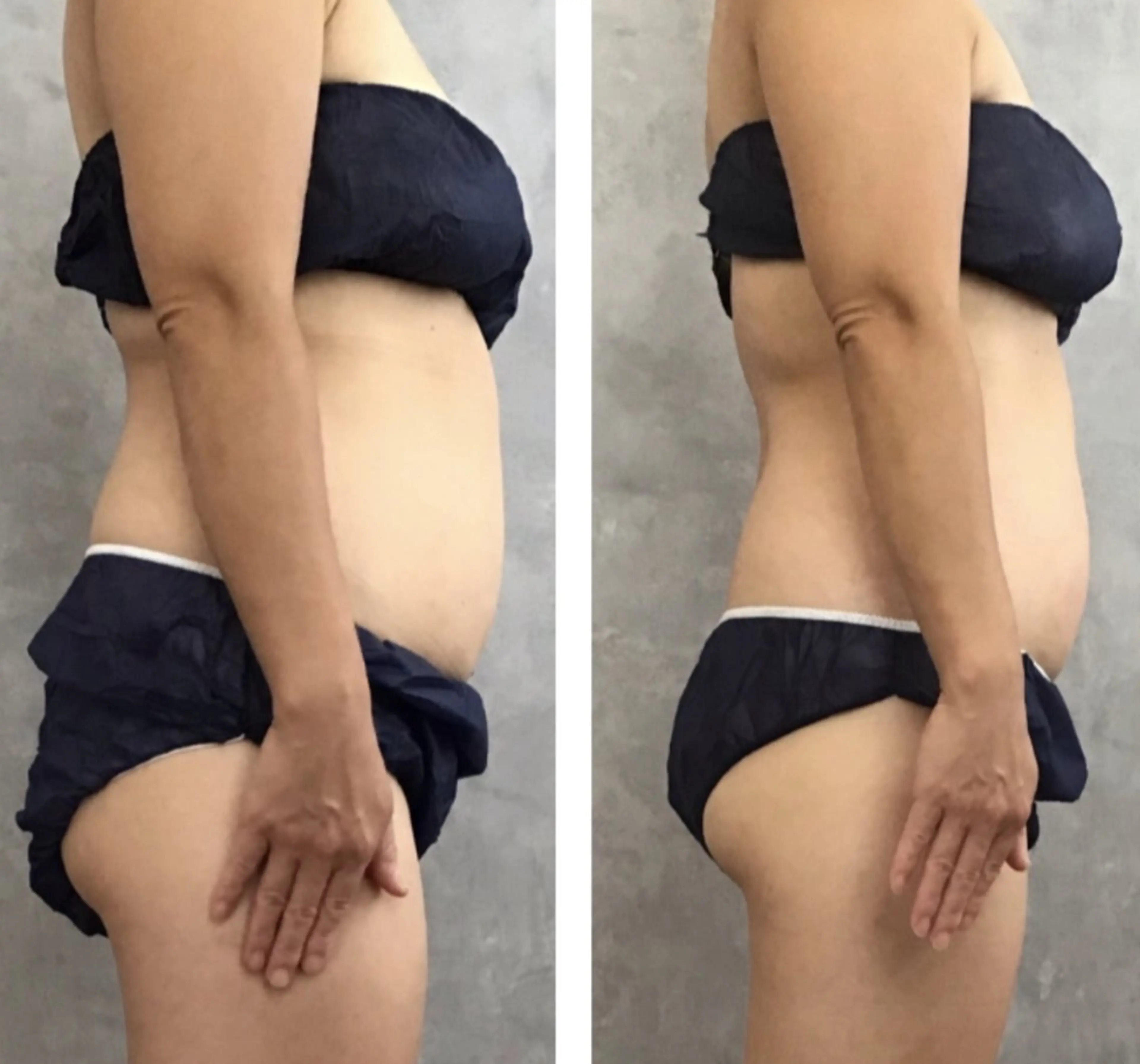 ヤマダ アキナのエステ・リラクイメージ