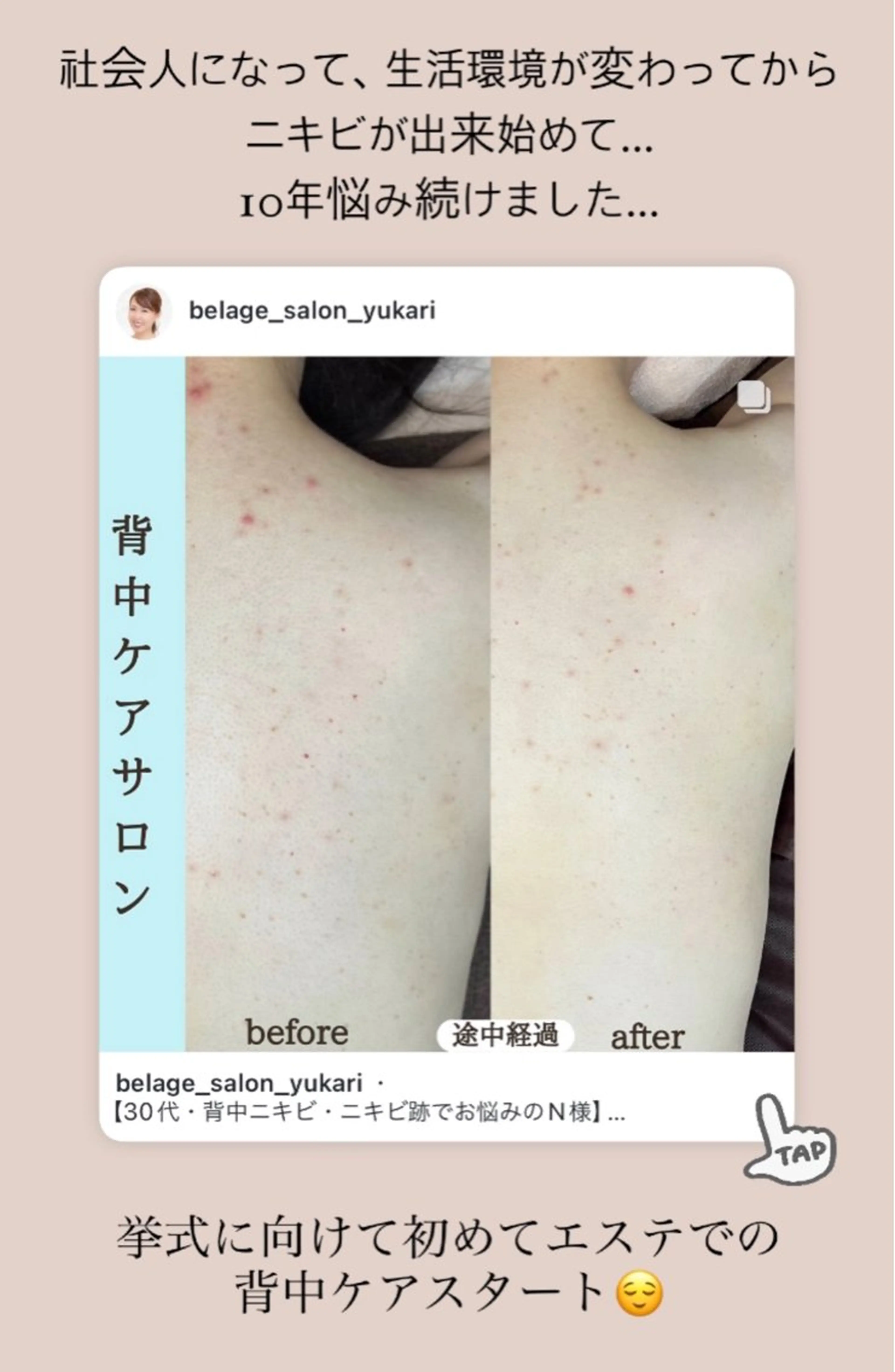 エステ ベラージュ【美背中・ 美尻・フェイシャル】のエステ・リラクイメージ