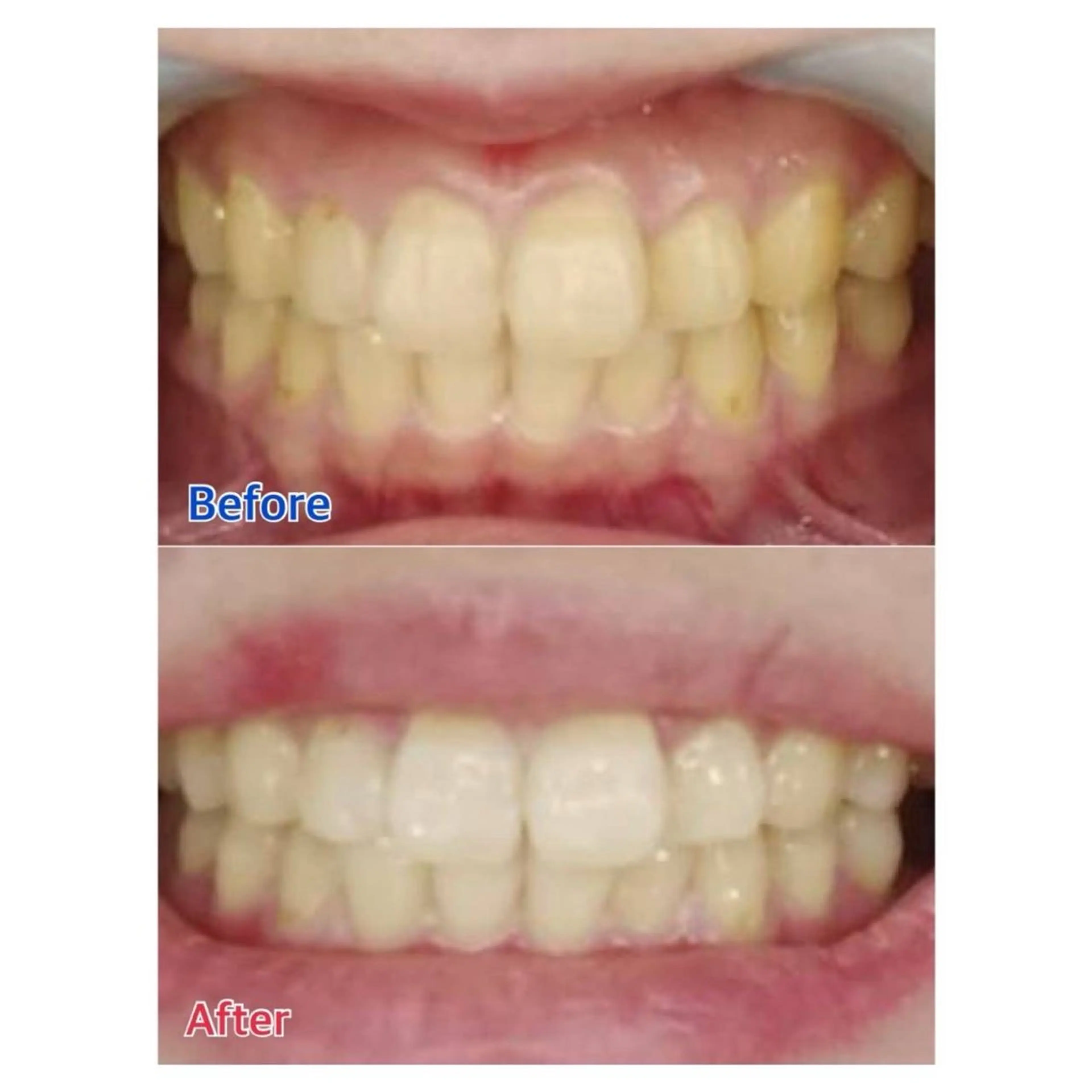 MBEAUTYSALON 千葉店・京成大久保所属・Melty 輝のその他イメージ