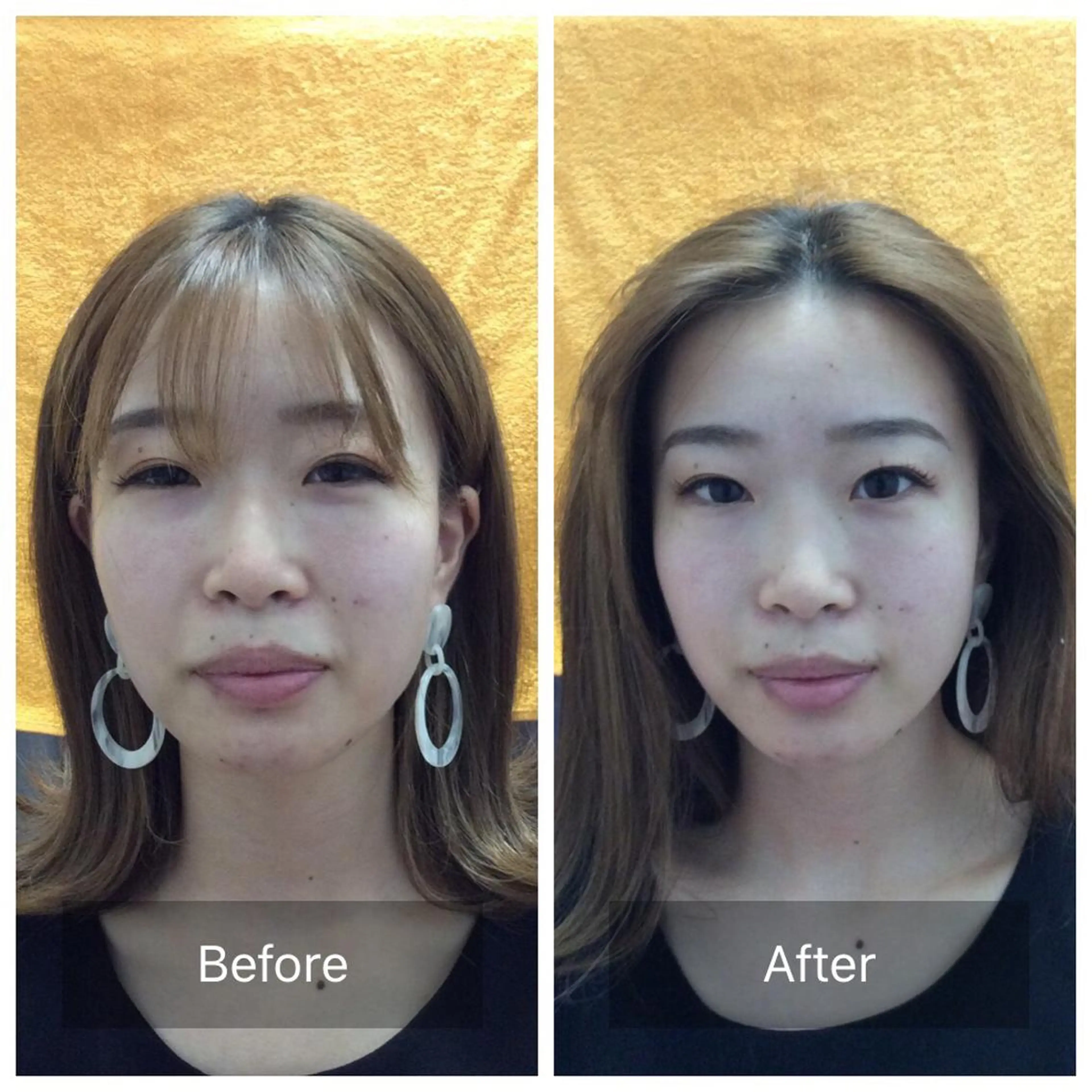 美容鍼・整体 根本改善/小林幸司のエステ・リラクイメージ