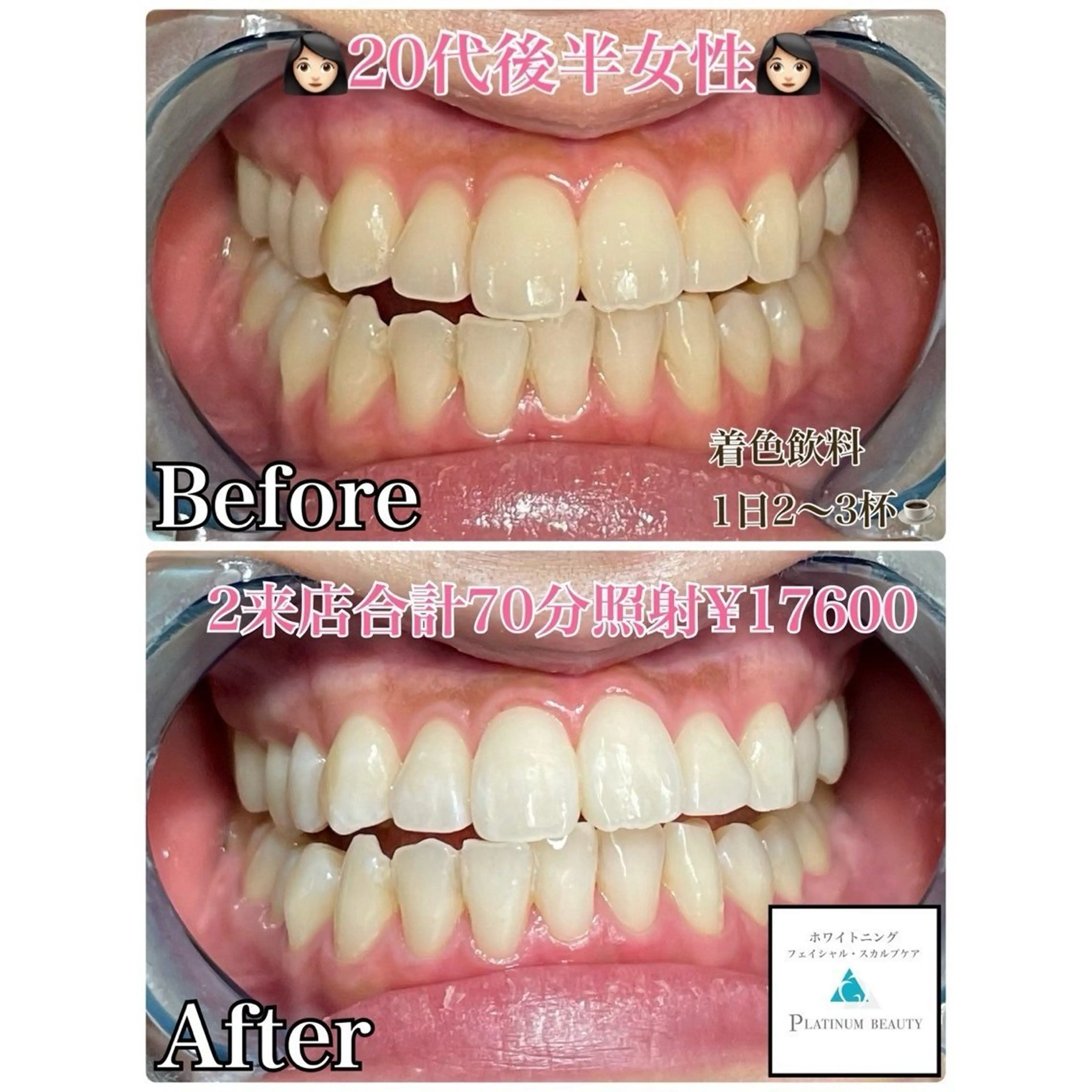 Whitening Beauty 行橋店所属・Whitening Beauty 行橋店のその他イメージ