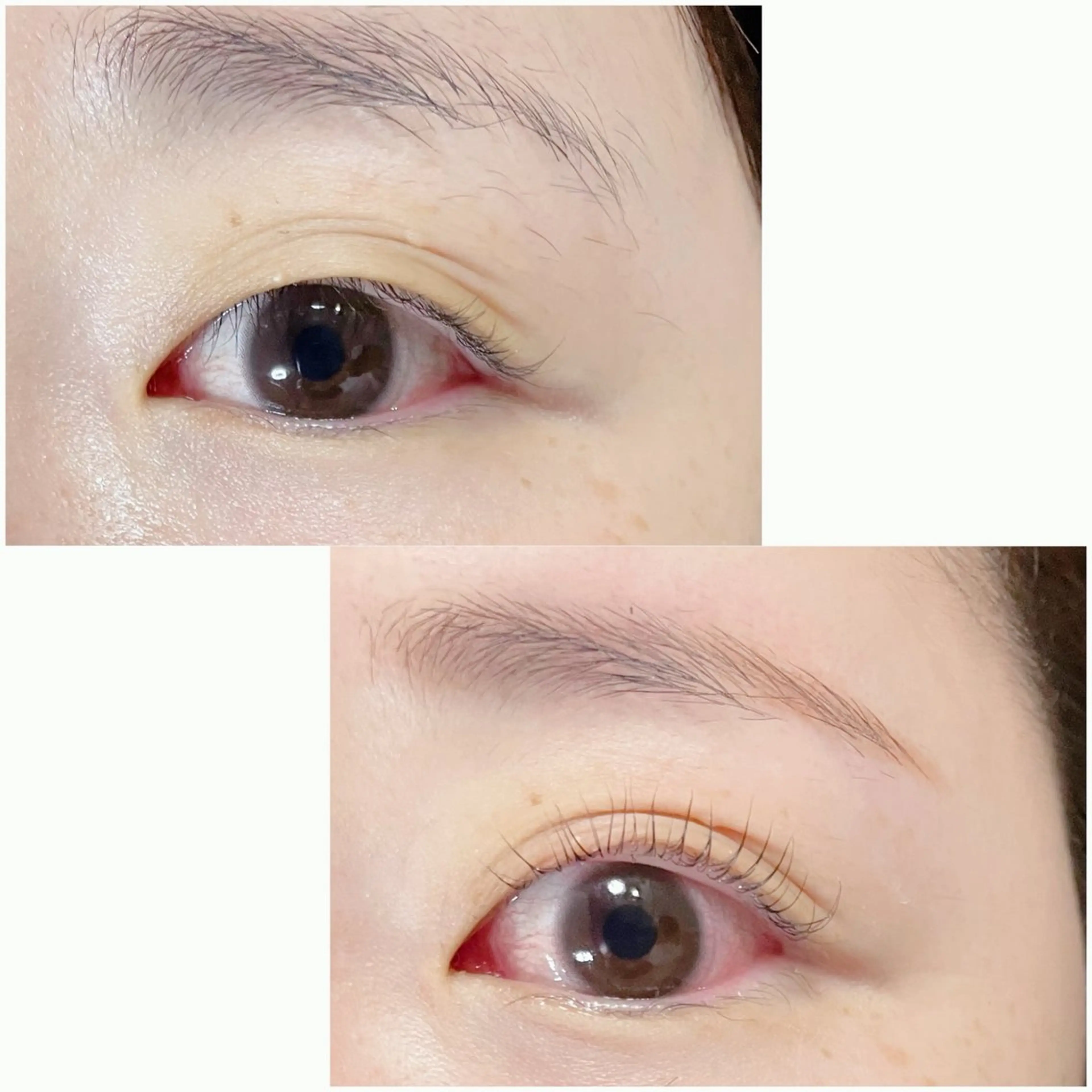 【目元の筋膜リリース】ダブルアイリフトの写真