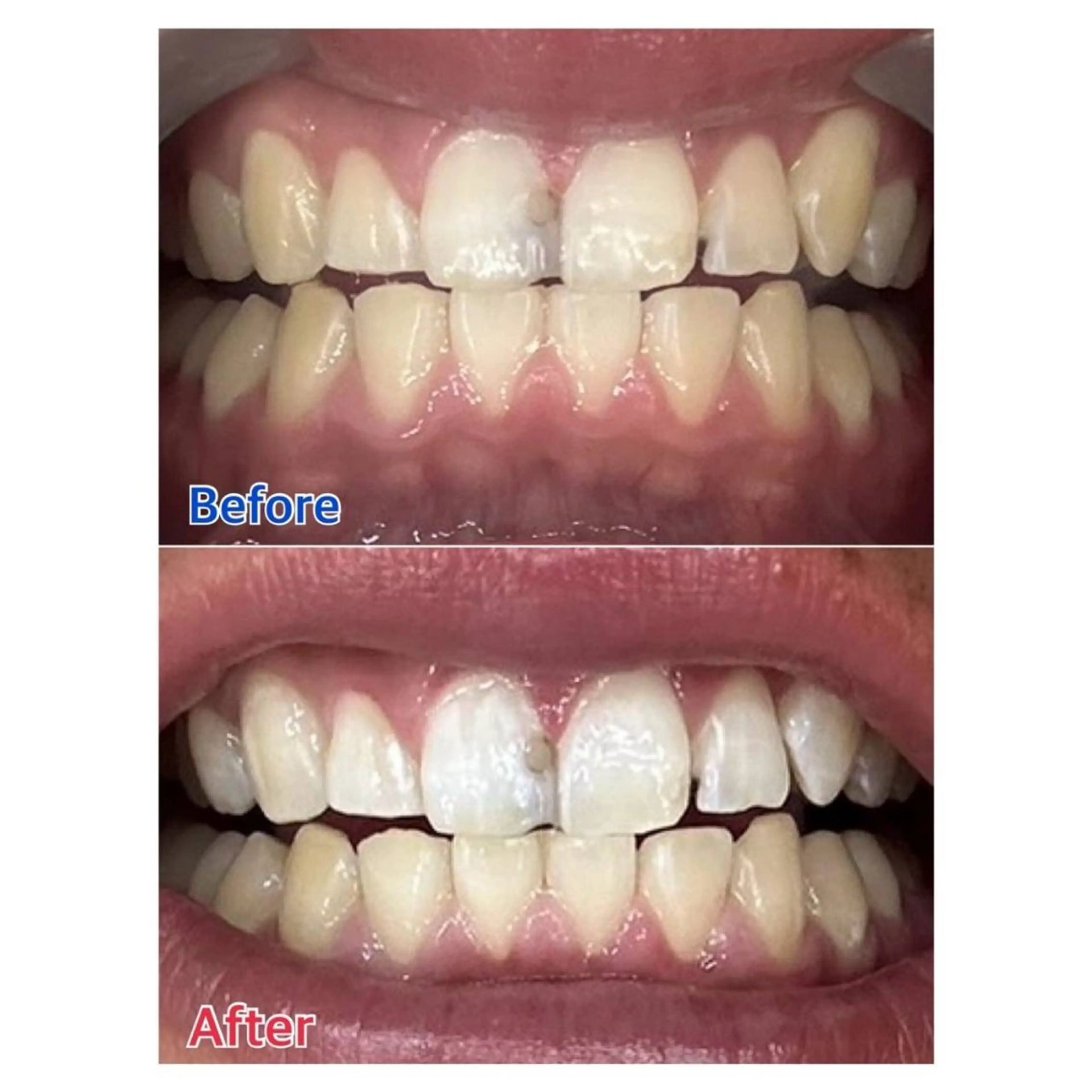 MBEAUTYSALON 千葉店・京成大久保所属・Melty 輝のその他イメージ