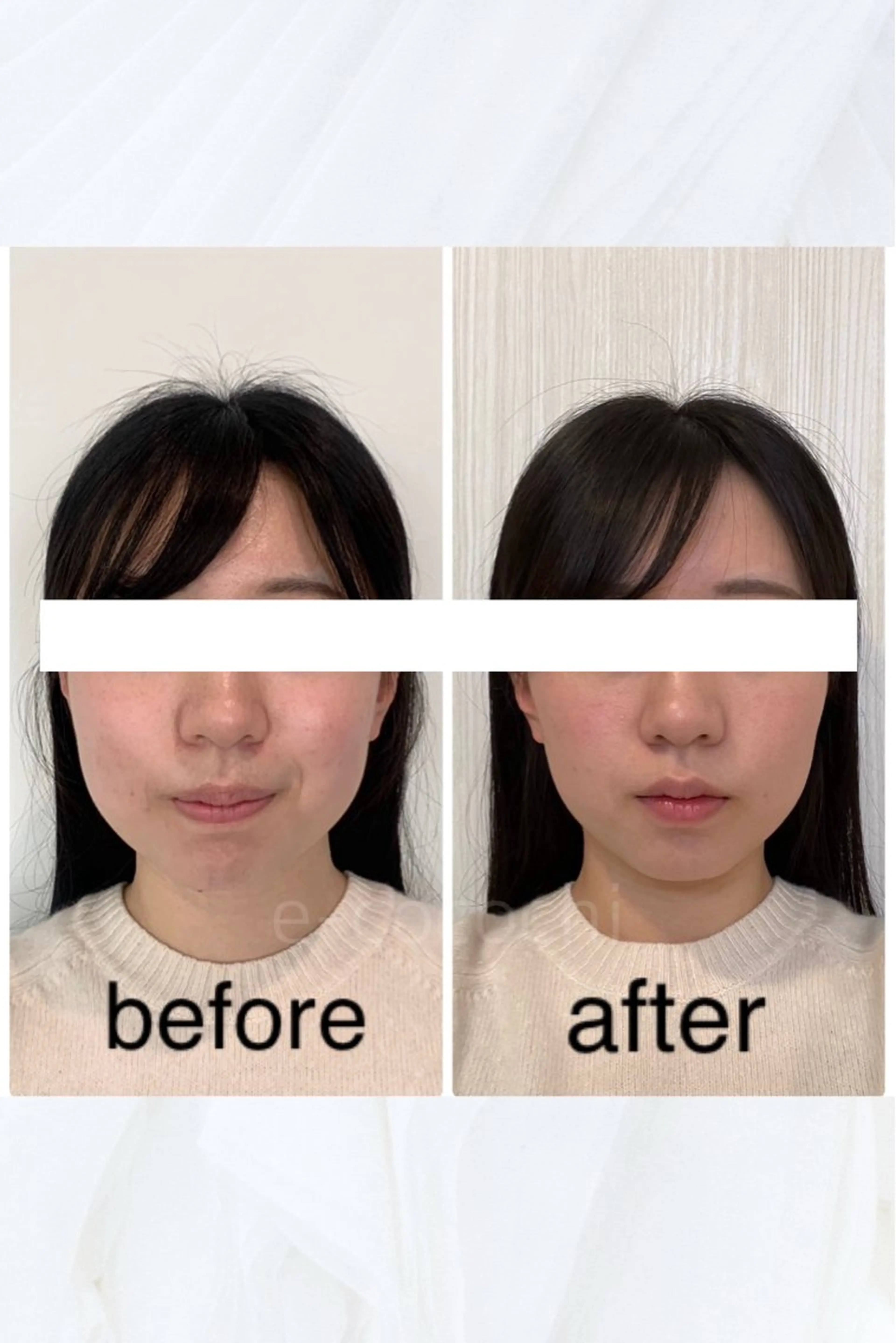 エステ リラク 小顔と ヘッドスパのお店のエステ・リラクイメージ