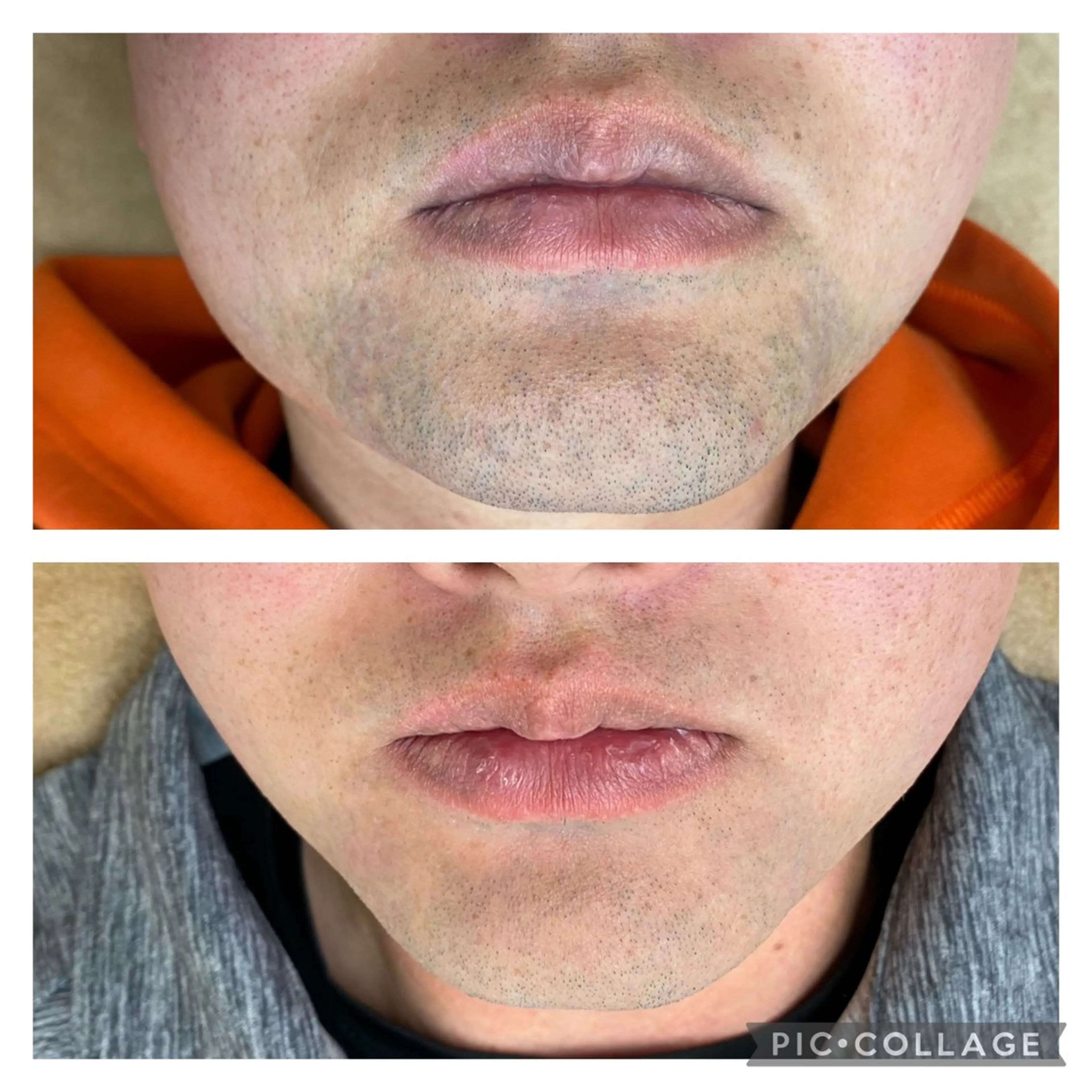 メンズ 脱毛 RE:moom リムーム/脱毛エステのエステ・リラクイメージ