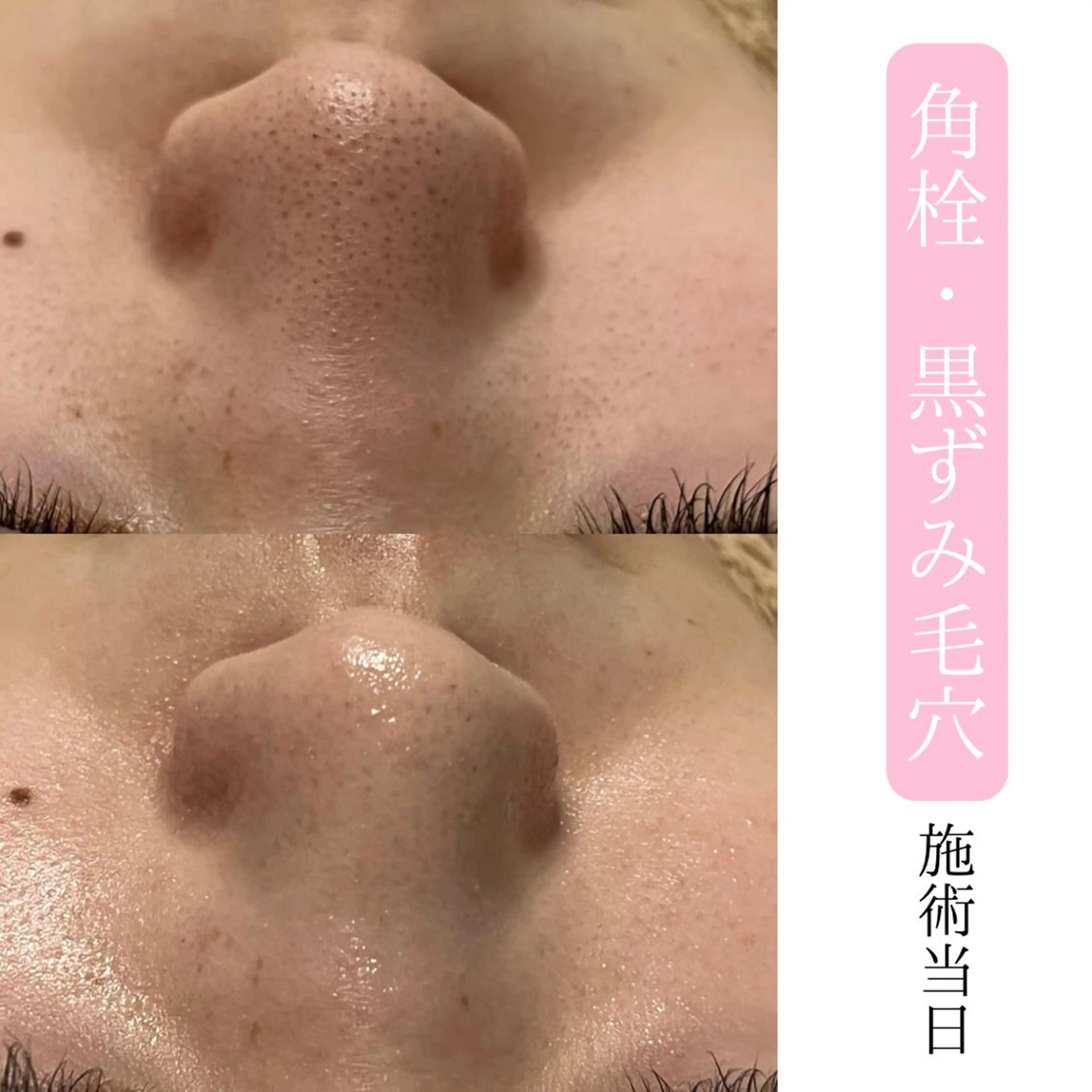 肌質改善サロン BestBelleのエステ・リラクイメージ