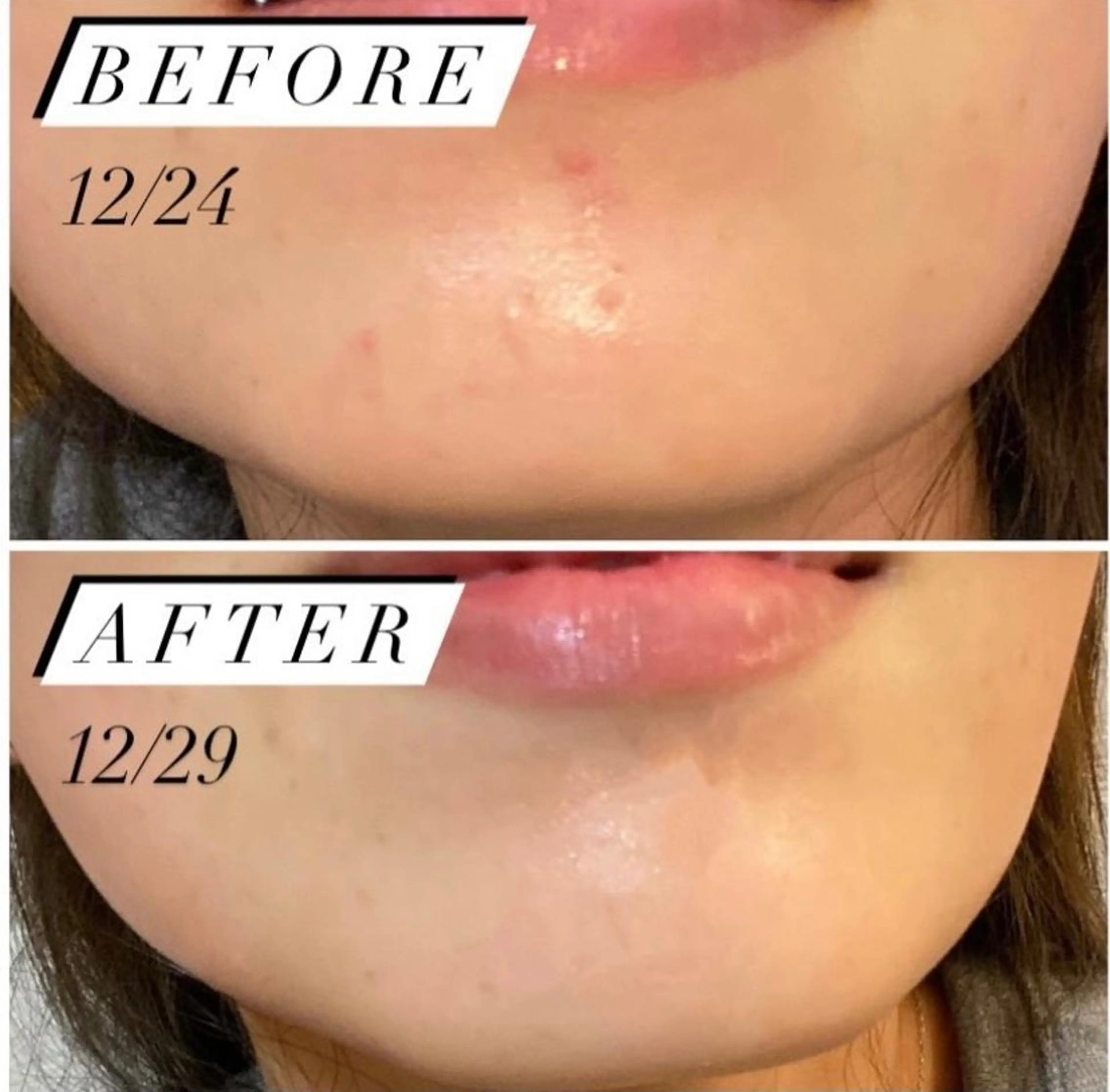 ハーブピーリング・毛穴ケア専門サロンSalon de LENA所属・ハーブピーリング 専門店/名古屋駅前店のその他イメージ