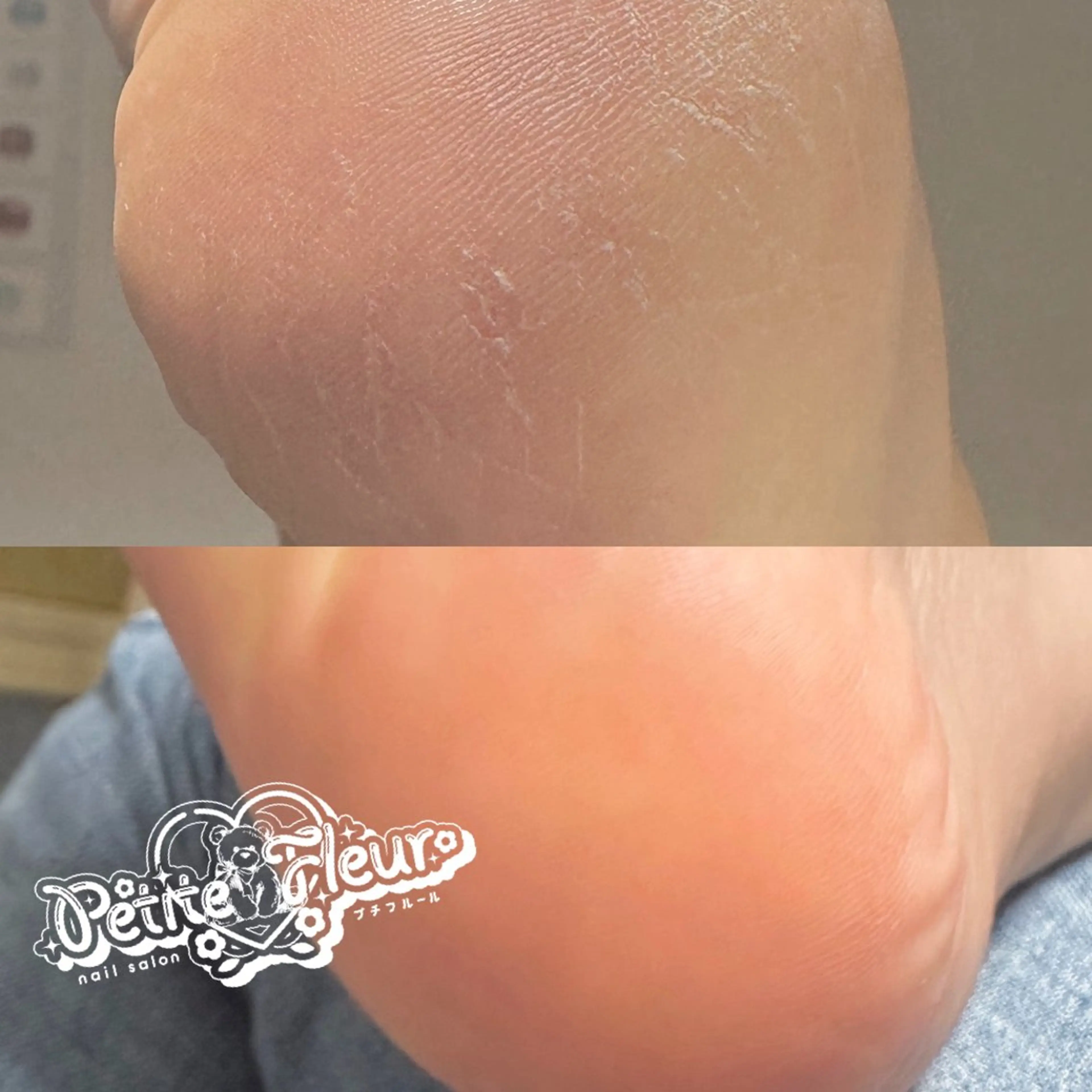 ネイル フットネイル ❁⃘*。Petite fleur❁⃘*りさのネイルデザイン