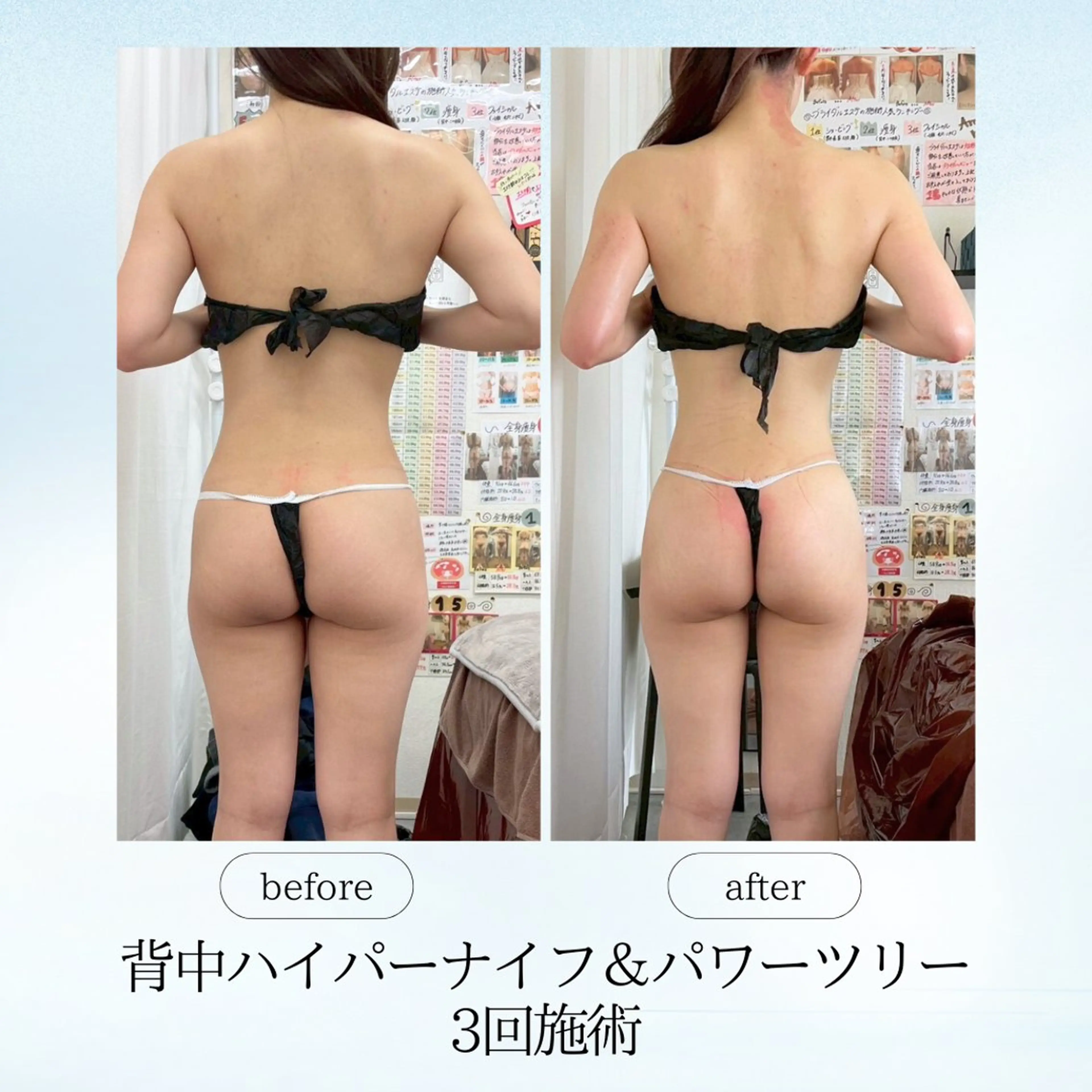 エステ リラク espresso,所属・《痩身、小顔専門店》 エスプレッソのエステ・リラクイメージ