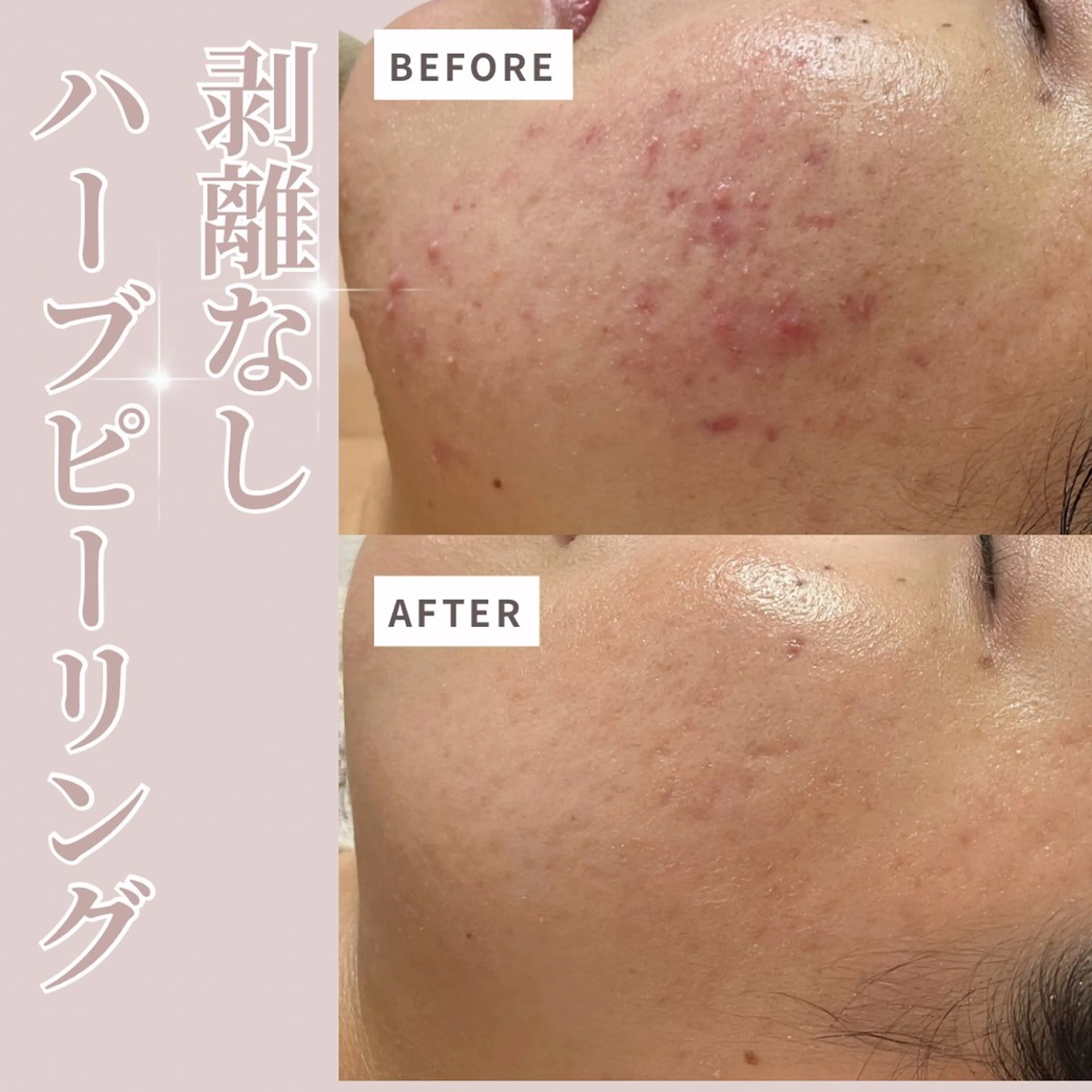 エステ プライベートサロン Belle（ベル）のエステ・リラクイメージ