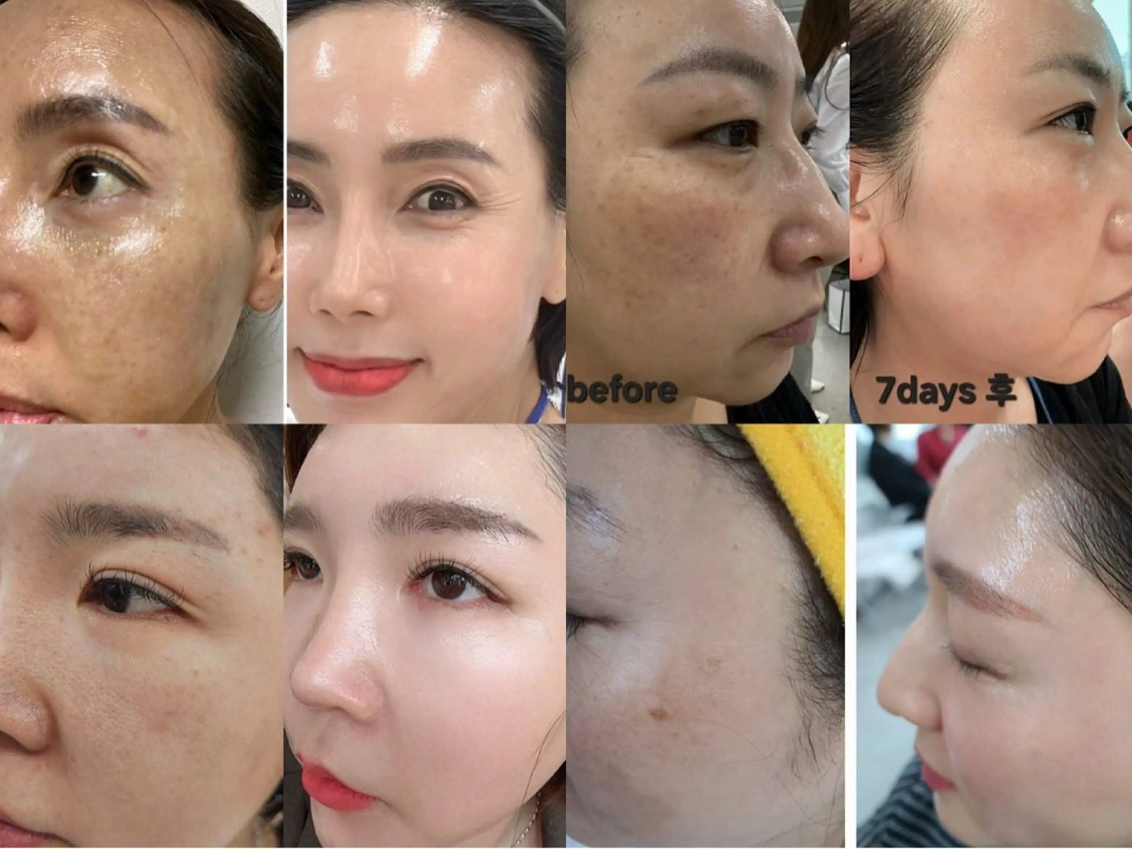 韓国コスメ【インセルダム】体験の写真