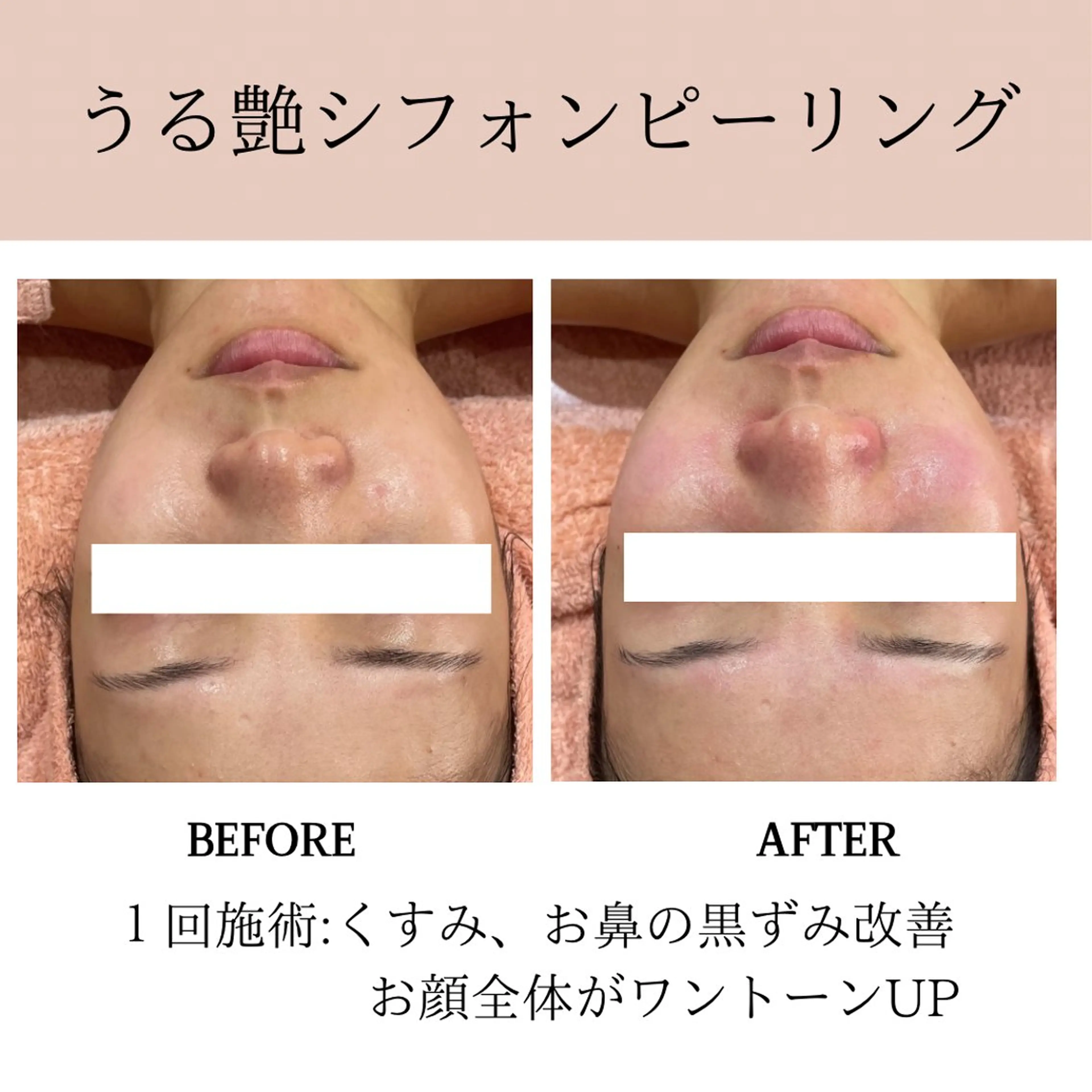 エステ 肌質改善専門サロン Bellmi/心斎橋のエステ・リラクイメージ