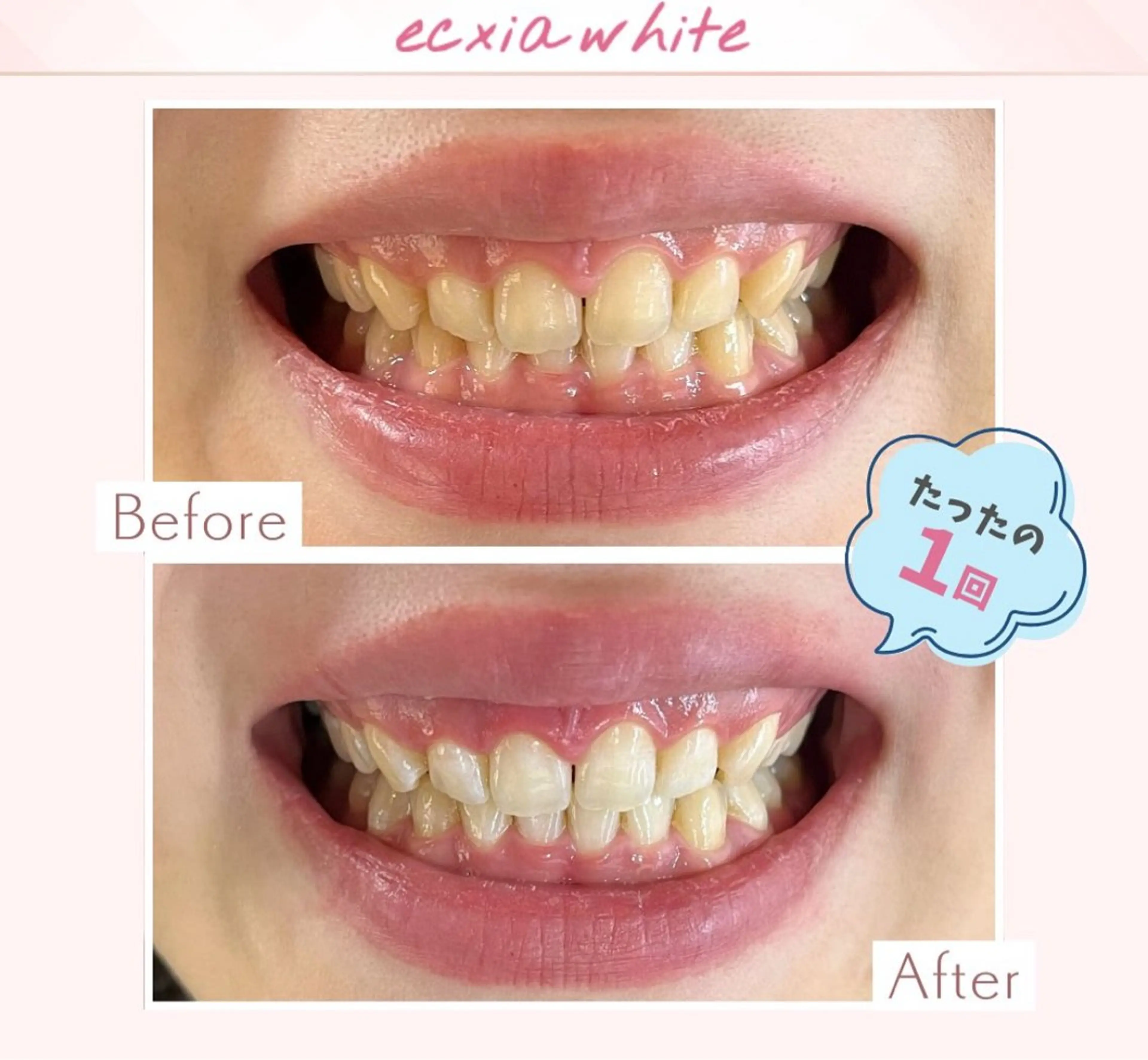 その他 セルフホワイトニングエクシア小山店所属・セルフホワイトニング エクシア小山店のその他イメージ