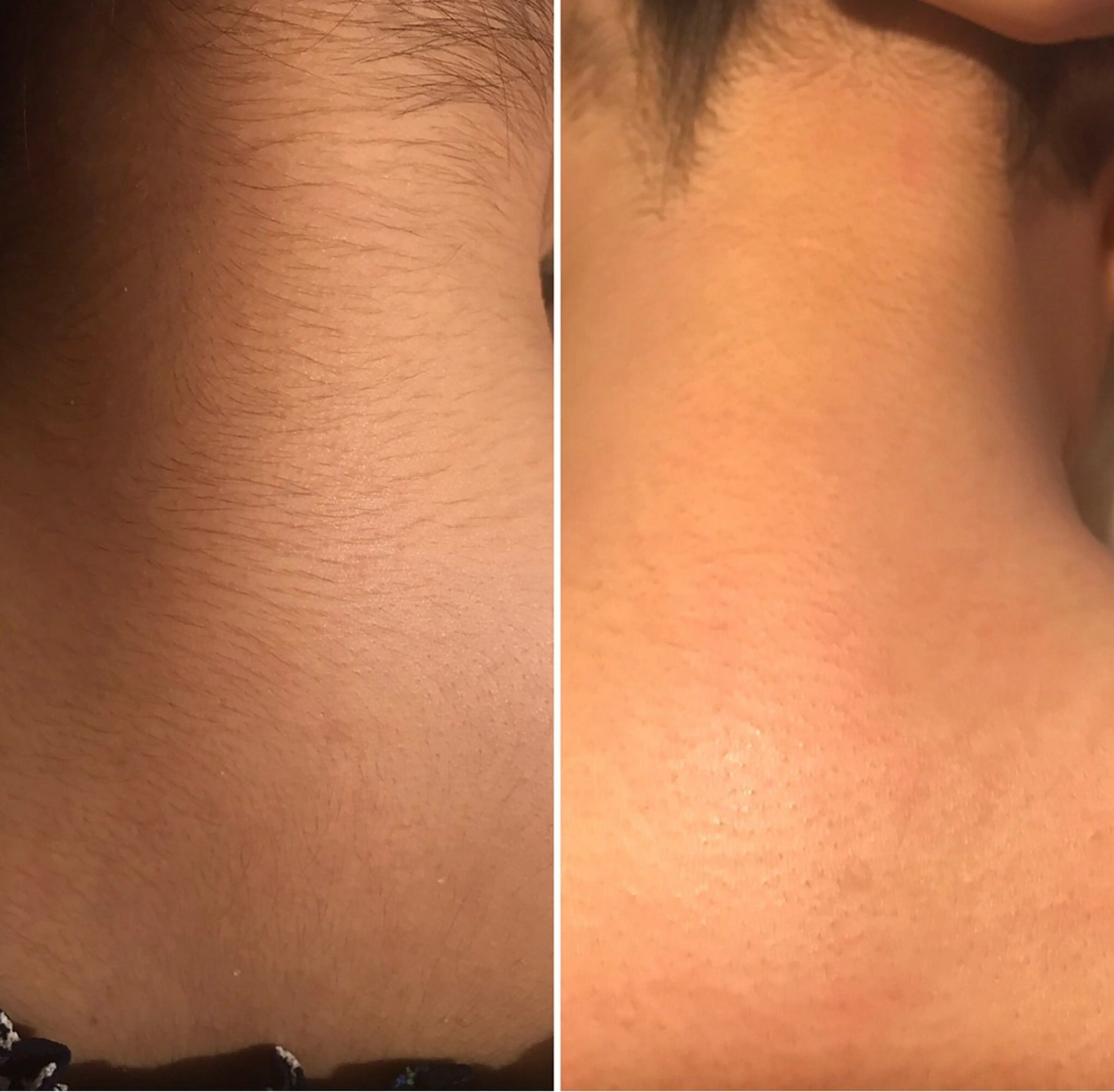 KoBa リンのマツエク・マツパデザイン