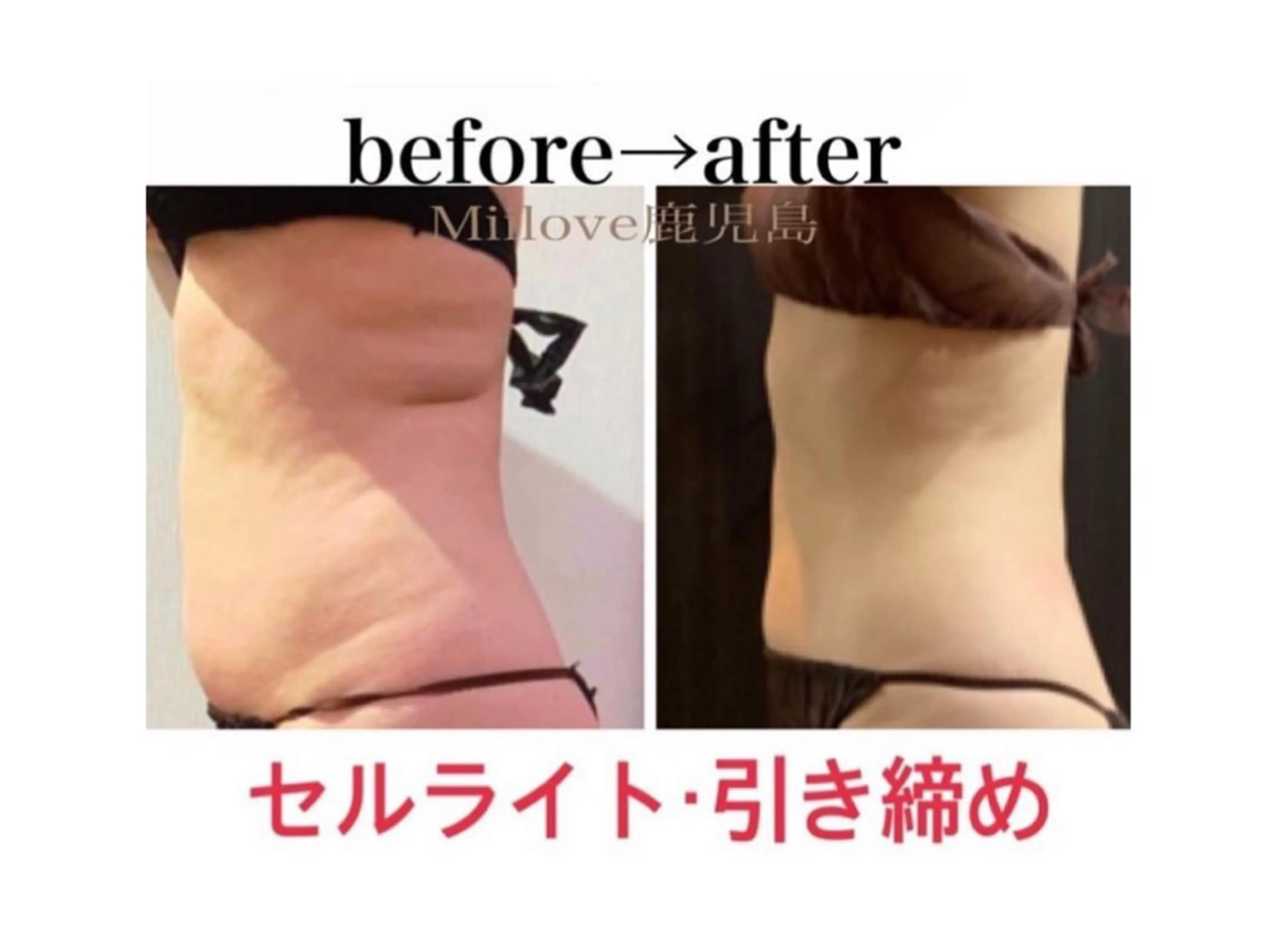 miilove 鹿児島店のエステ・リラクイメージ