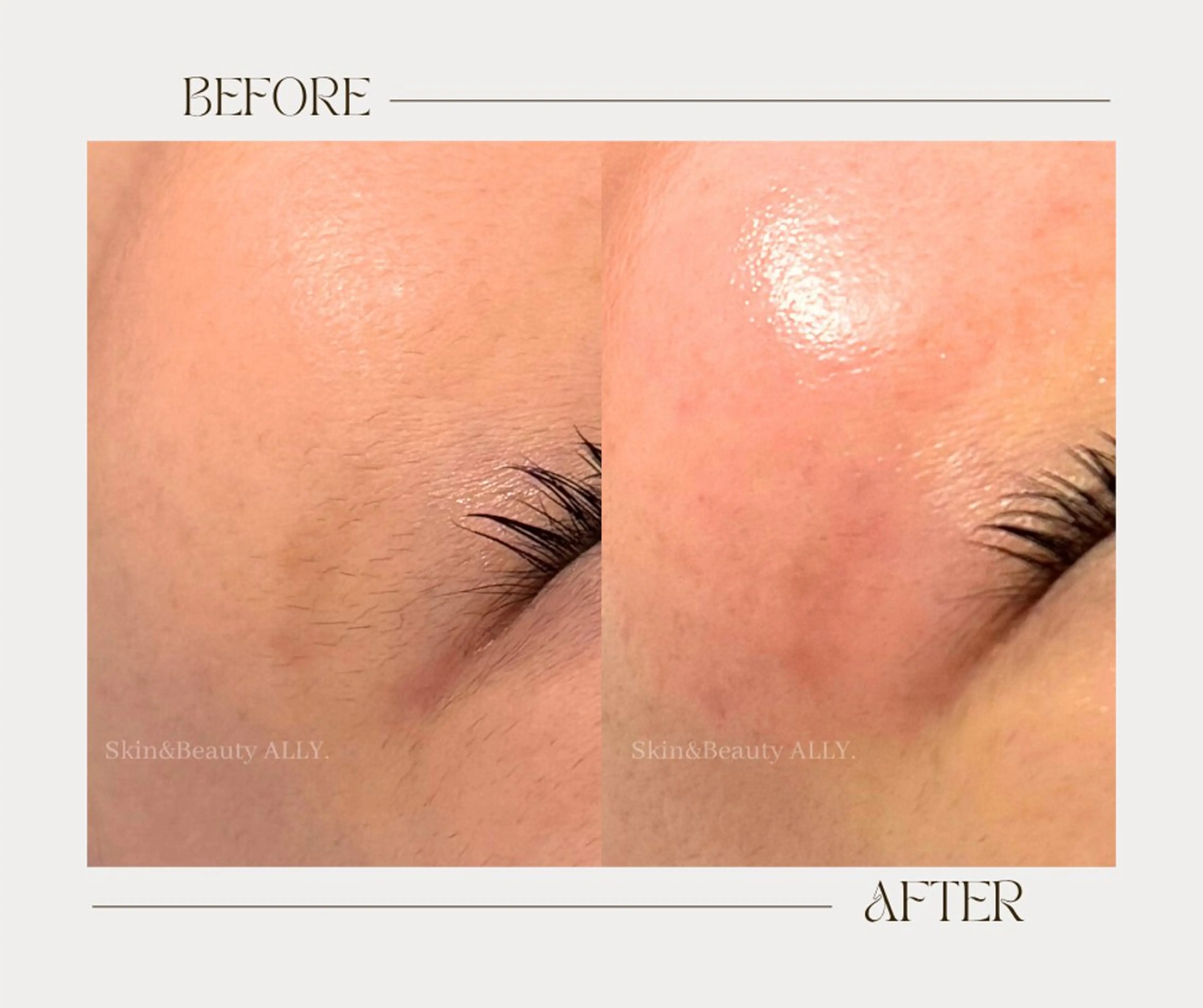 その他 艶肌ワックス ALLY.のエステ・リラクイメージ