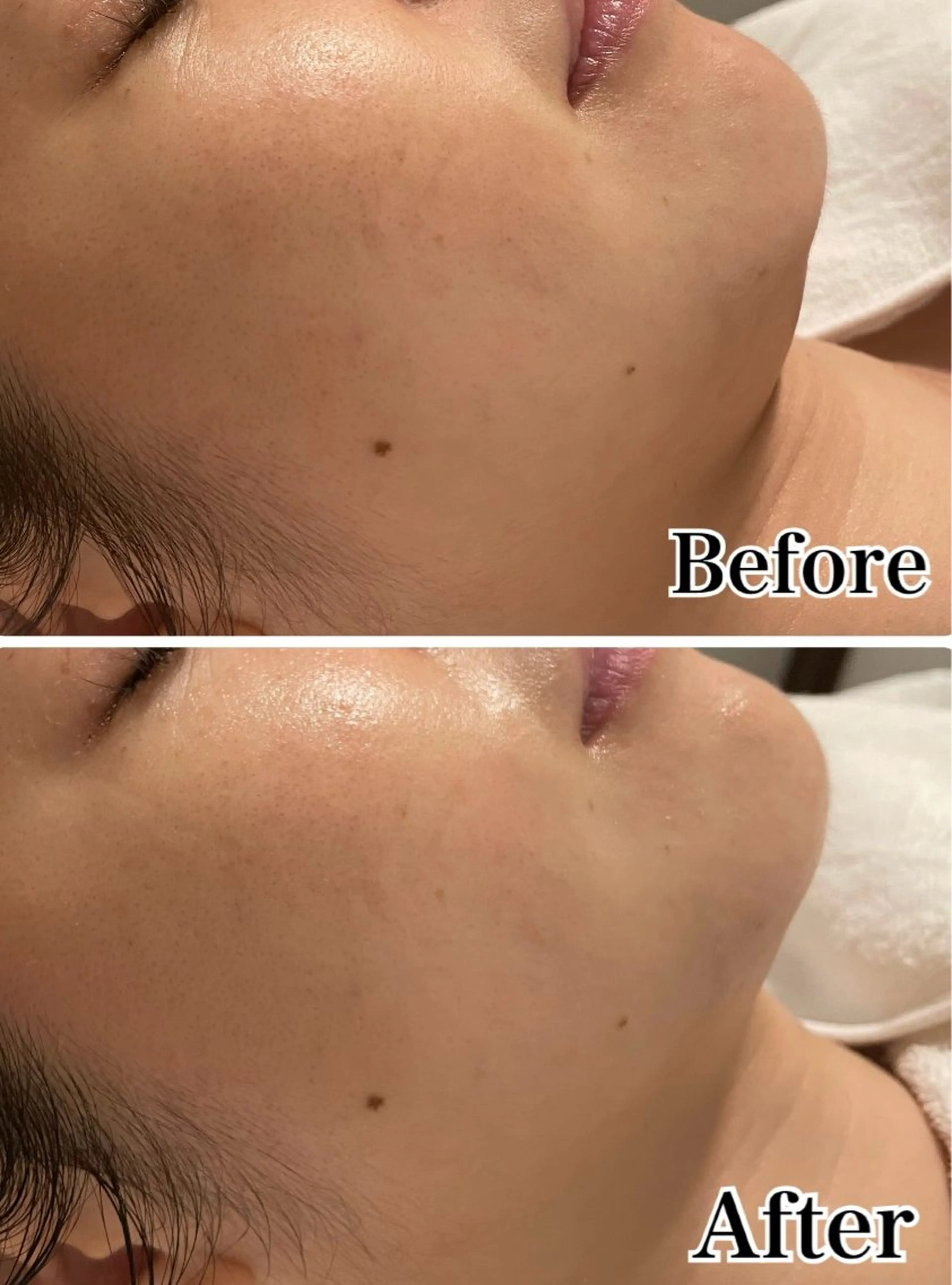 デ・アイム豊中所属・朝山 紗世子のエステ・リラクイメージ