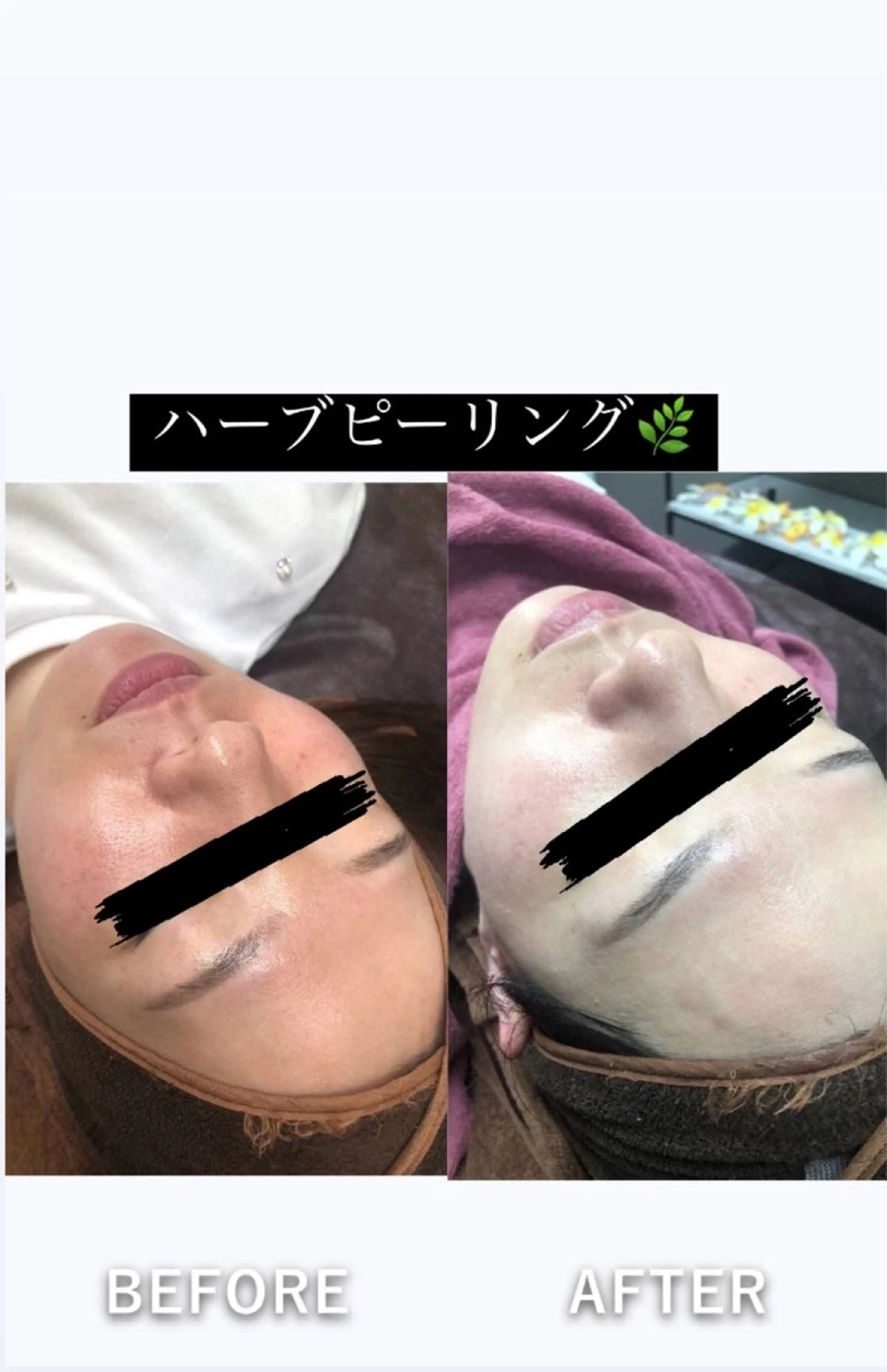 エステ 美容整体・塗る漢方・フェイシャルRechica所属・心斎橋痩身 美肌整体サロン💓のエステ・リラクイメージ