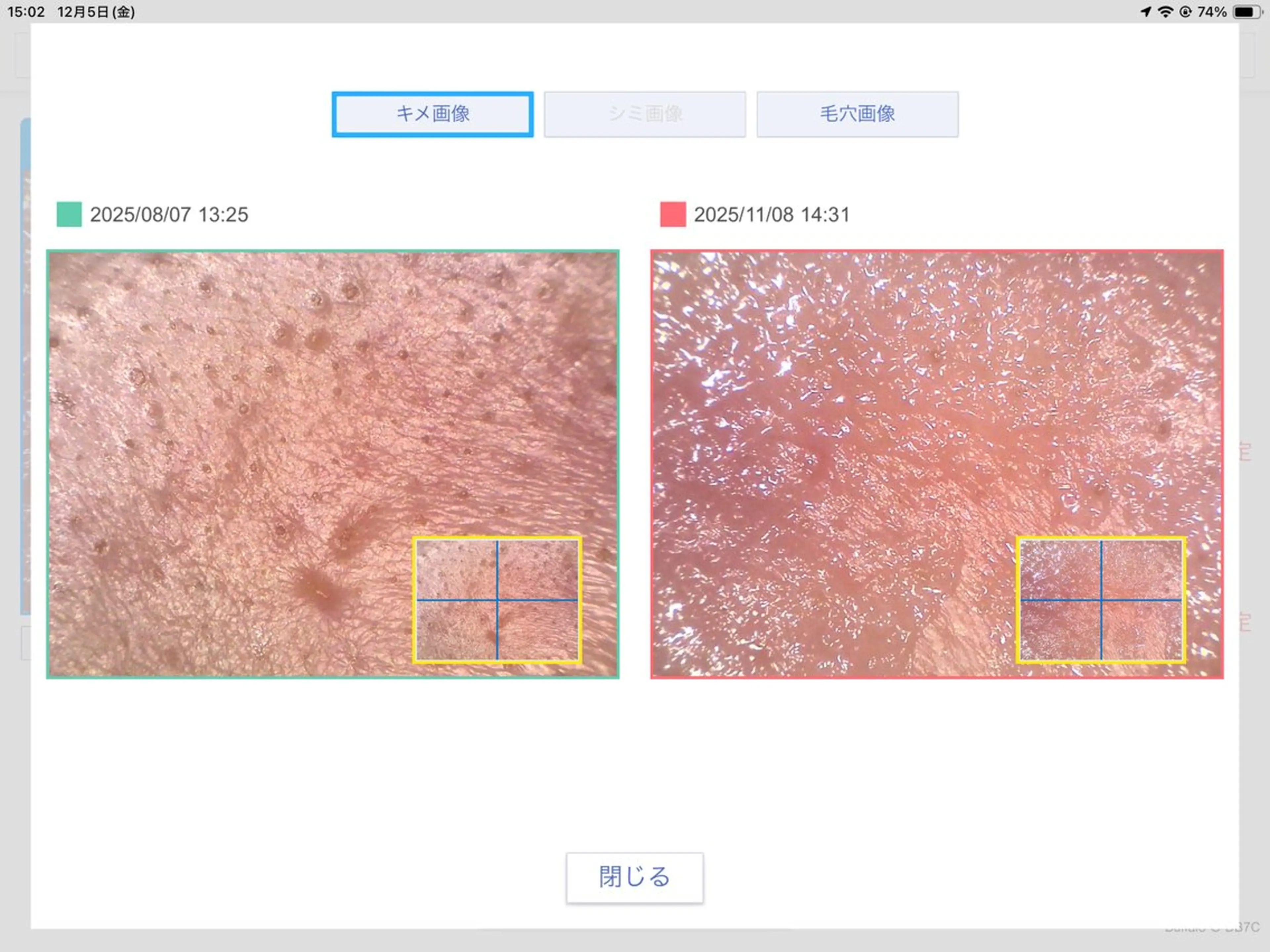 エステ 毛穴専門店Bébéもりの里店所属・毛穴専門店Bébé もりの里店のエステ・リラクイメージ