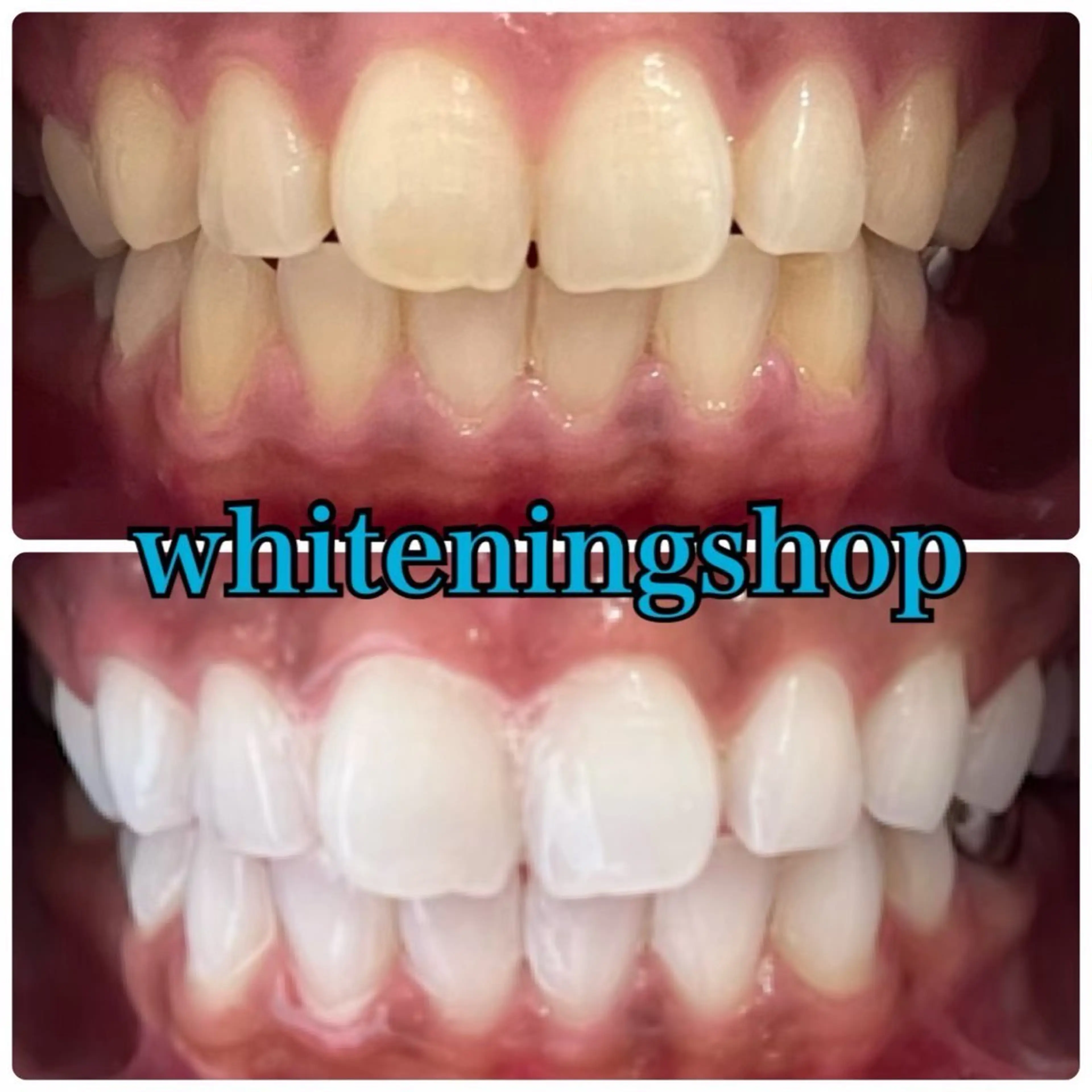 その他 ホワイトニングショップせんげん台店所属・スタッフ 兎洞のその他イメージ