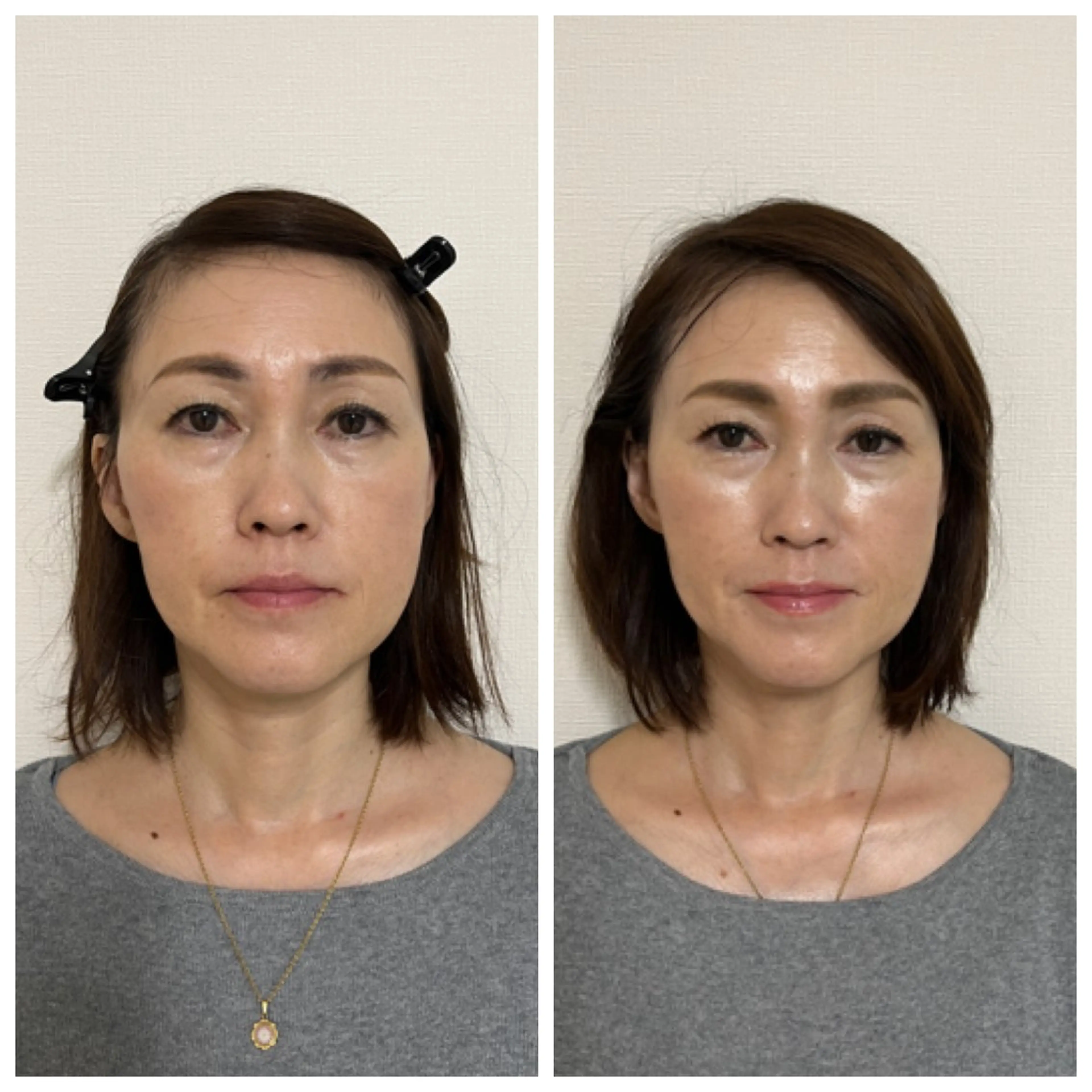 【ハーブピーリング】 Allumentのエステ・リラクイメージ