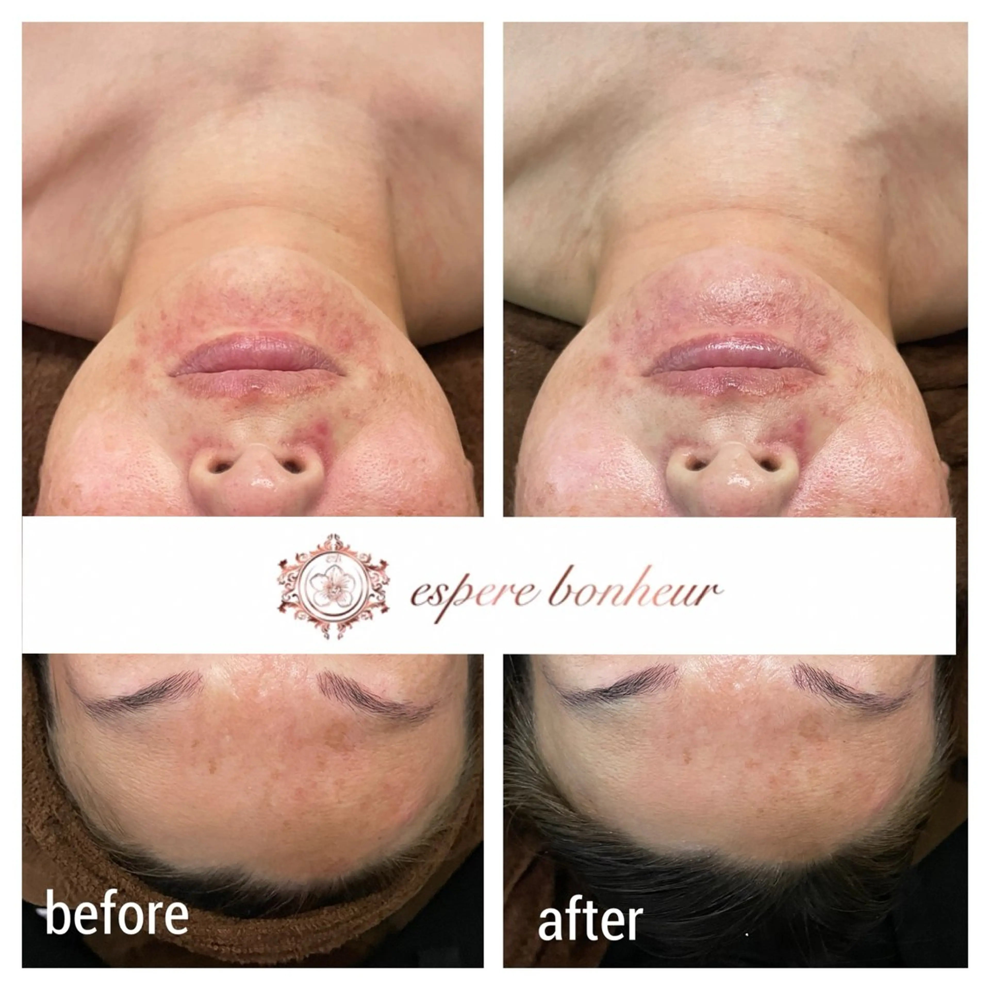 エステ 角野 由美子のエステ・リラクイメージ