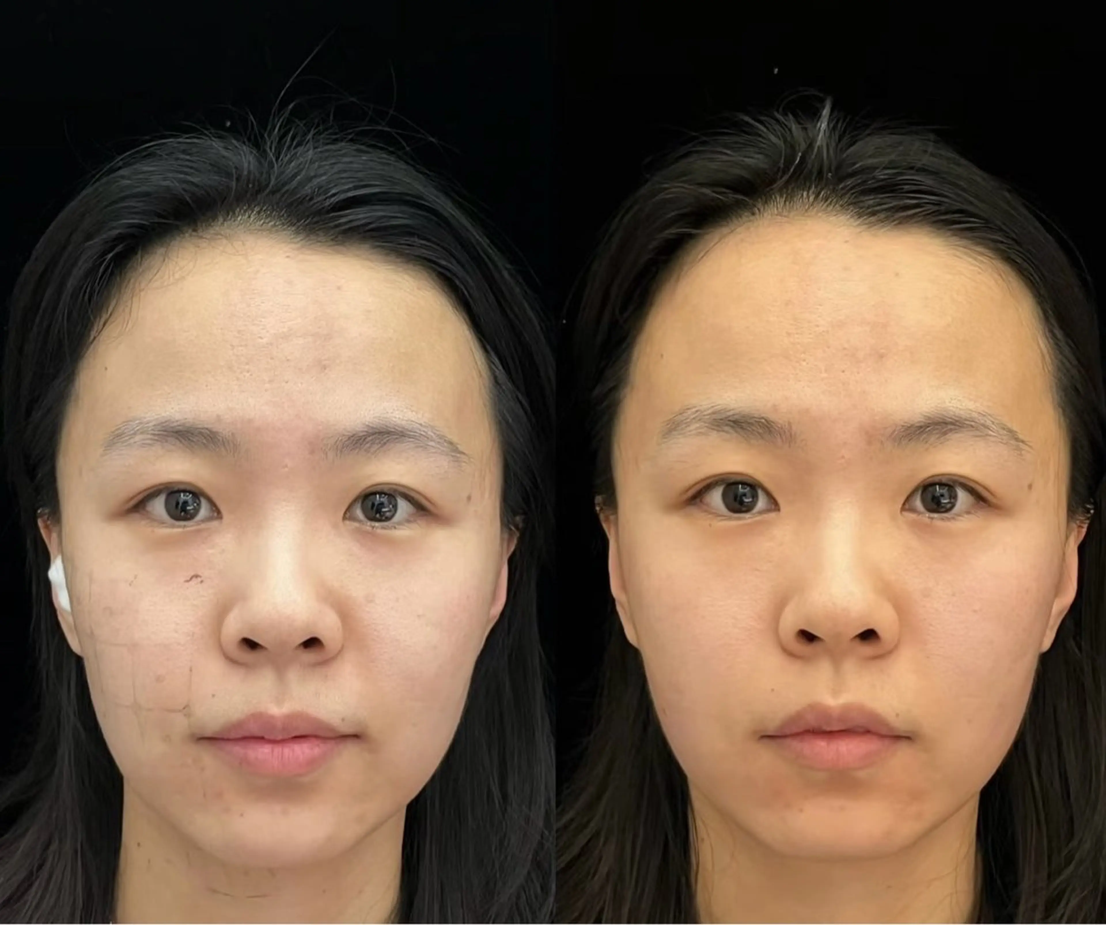 ショート エステ 愛維美水光美肌専門店所属・愛維美水光美肌専門店 メンズレディースokのエステ・リラクイメージ