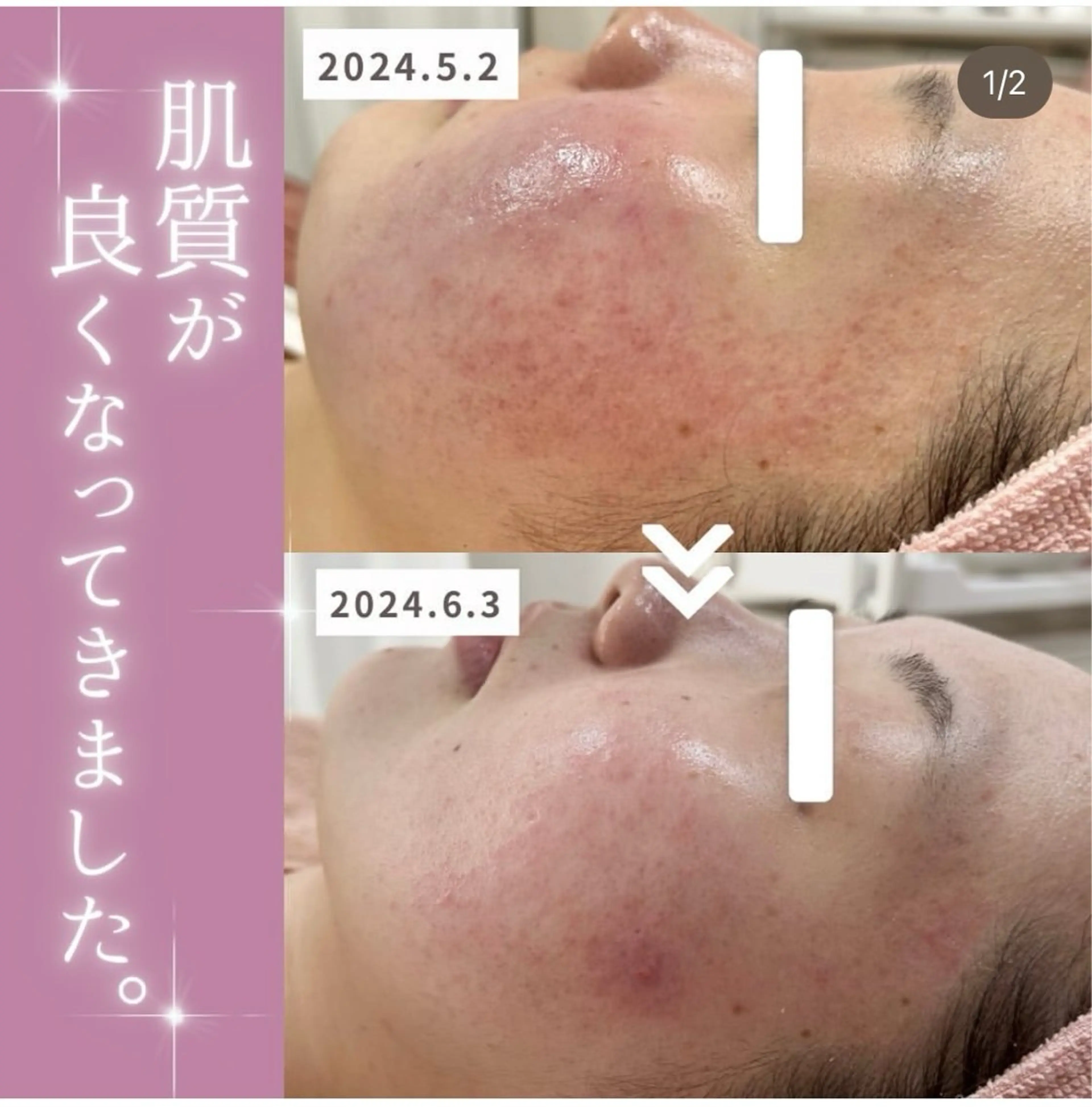 エステ 【現役看護師】高来 笑子のエステ・リラクイメージ