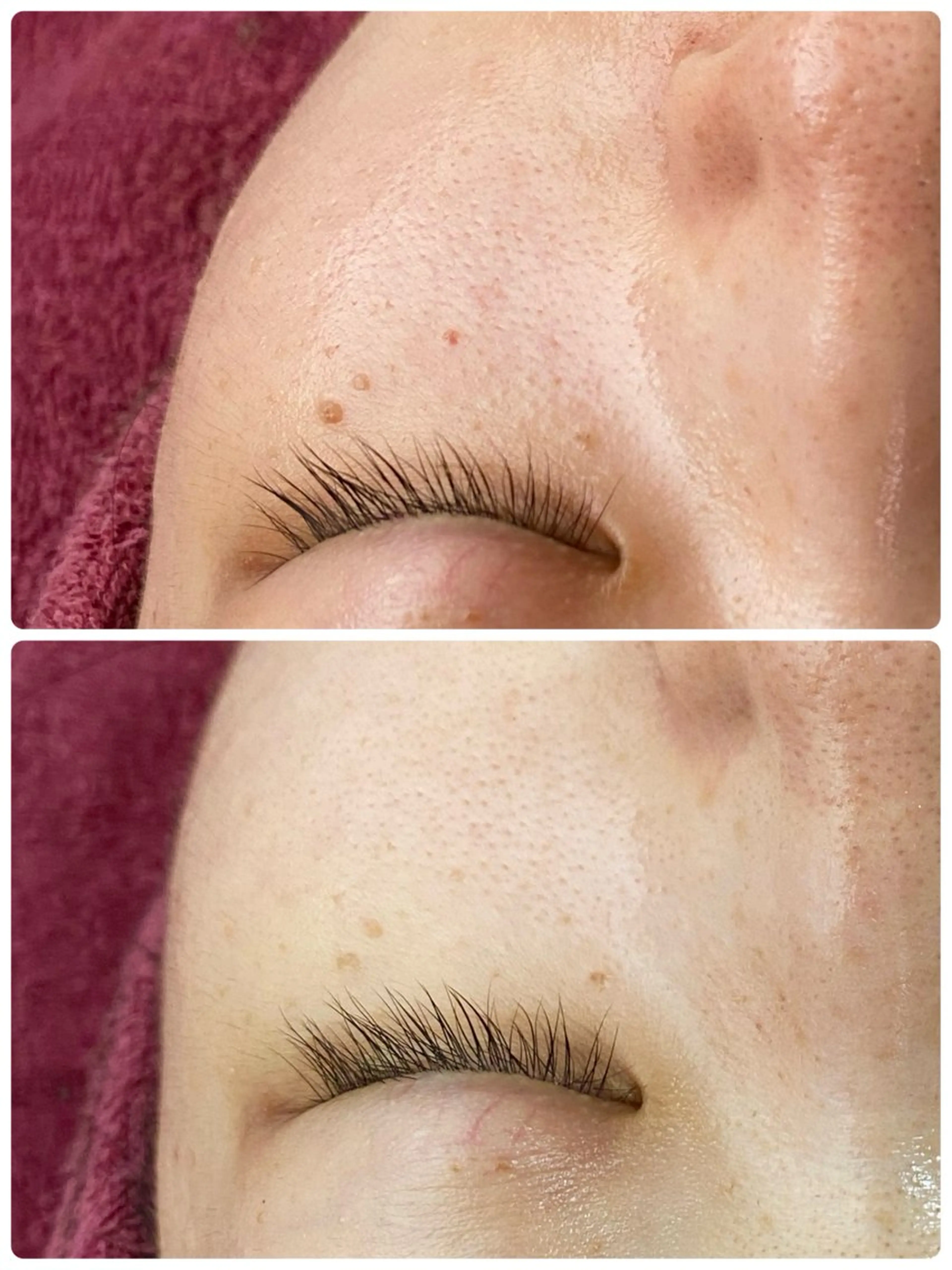 エステ Chalon所属・REVI取扱・肌悩み 毛穴Chalonのエステ・リラクイメージ