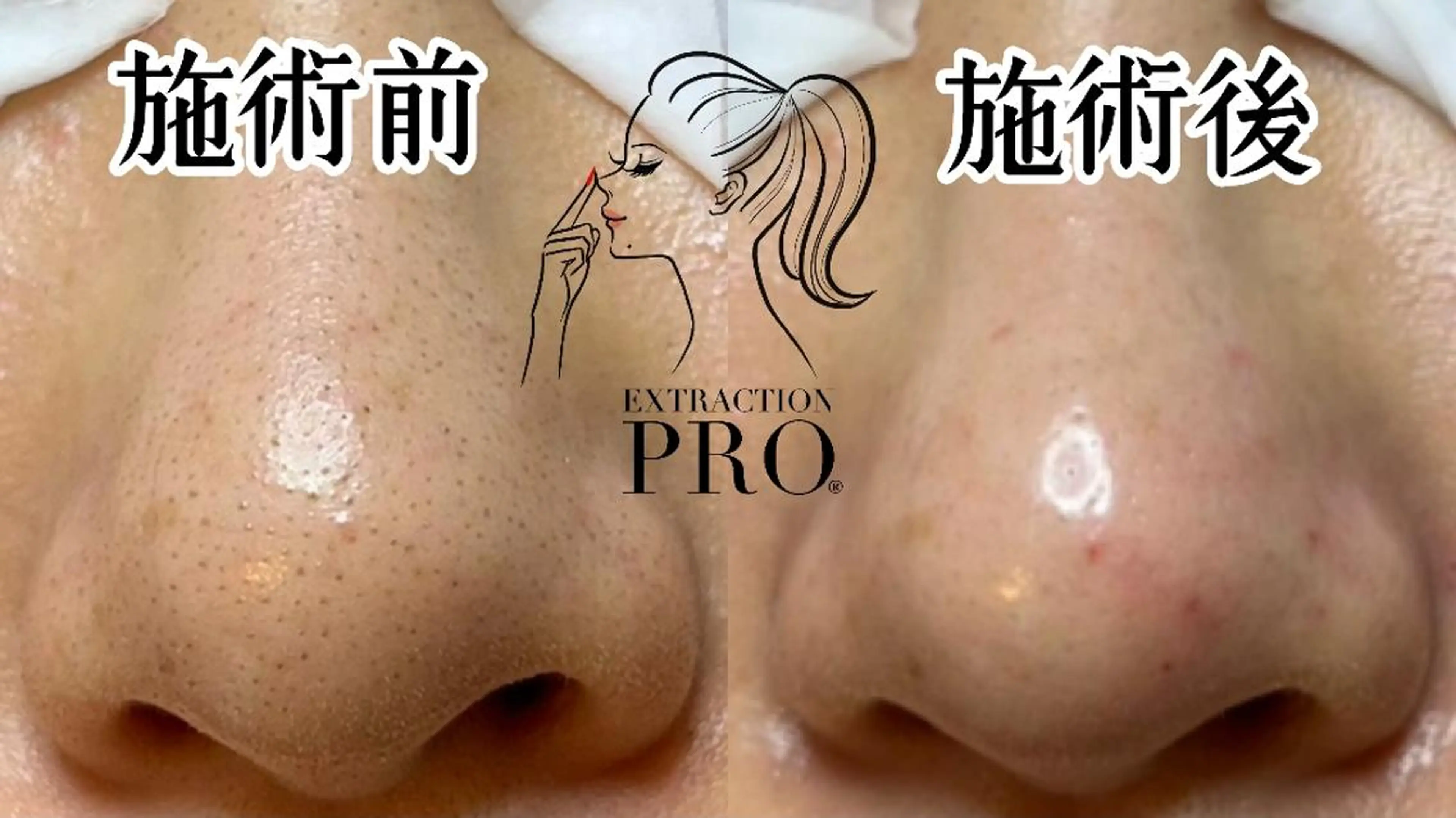 エステ Lipula リプラ所属・毛穴ツヤ肌専門    Lipulaのエステ・リラクイメージ