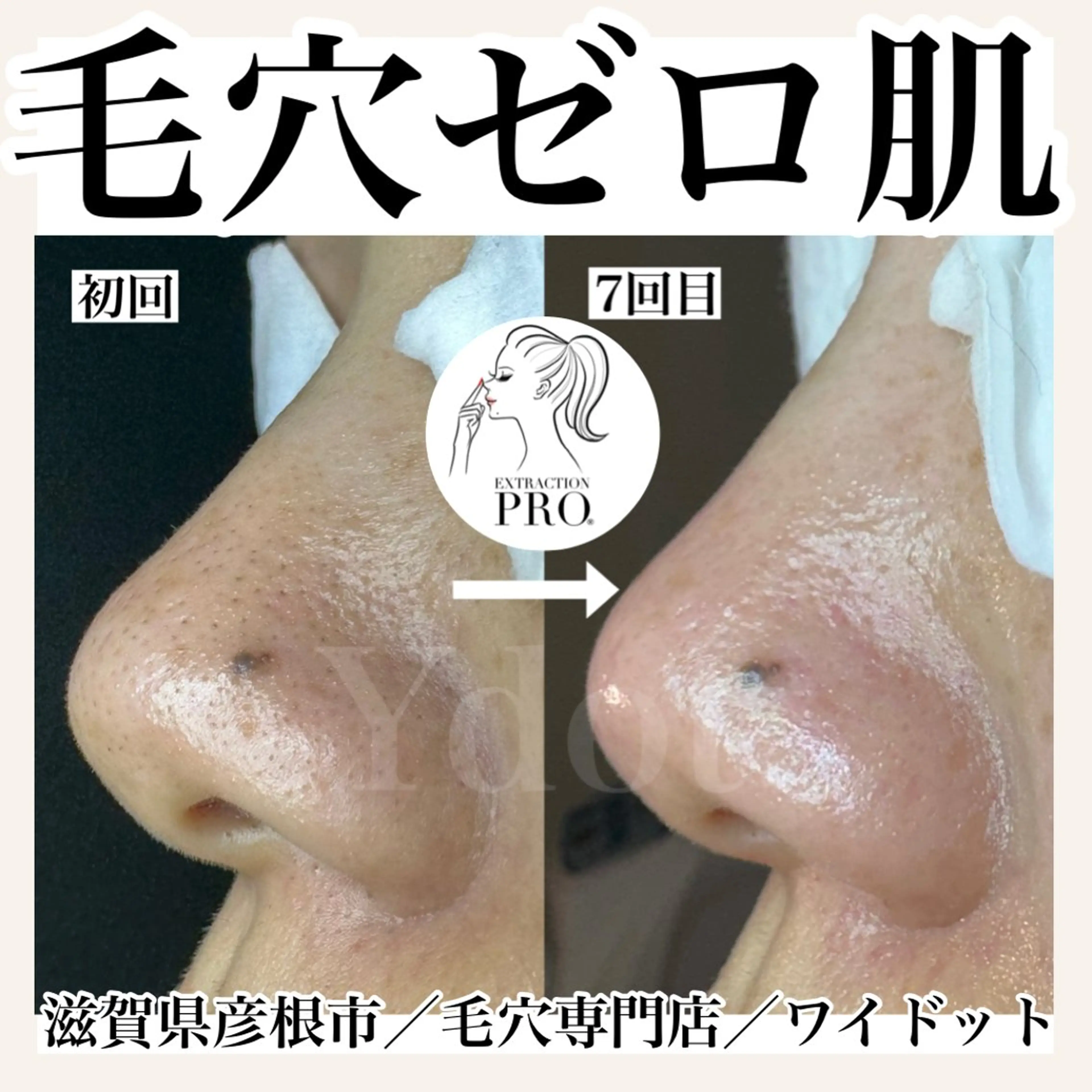 エステ Ydot. 池内 友架のエステ・リラクイメージ