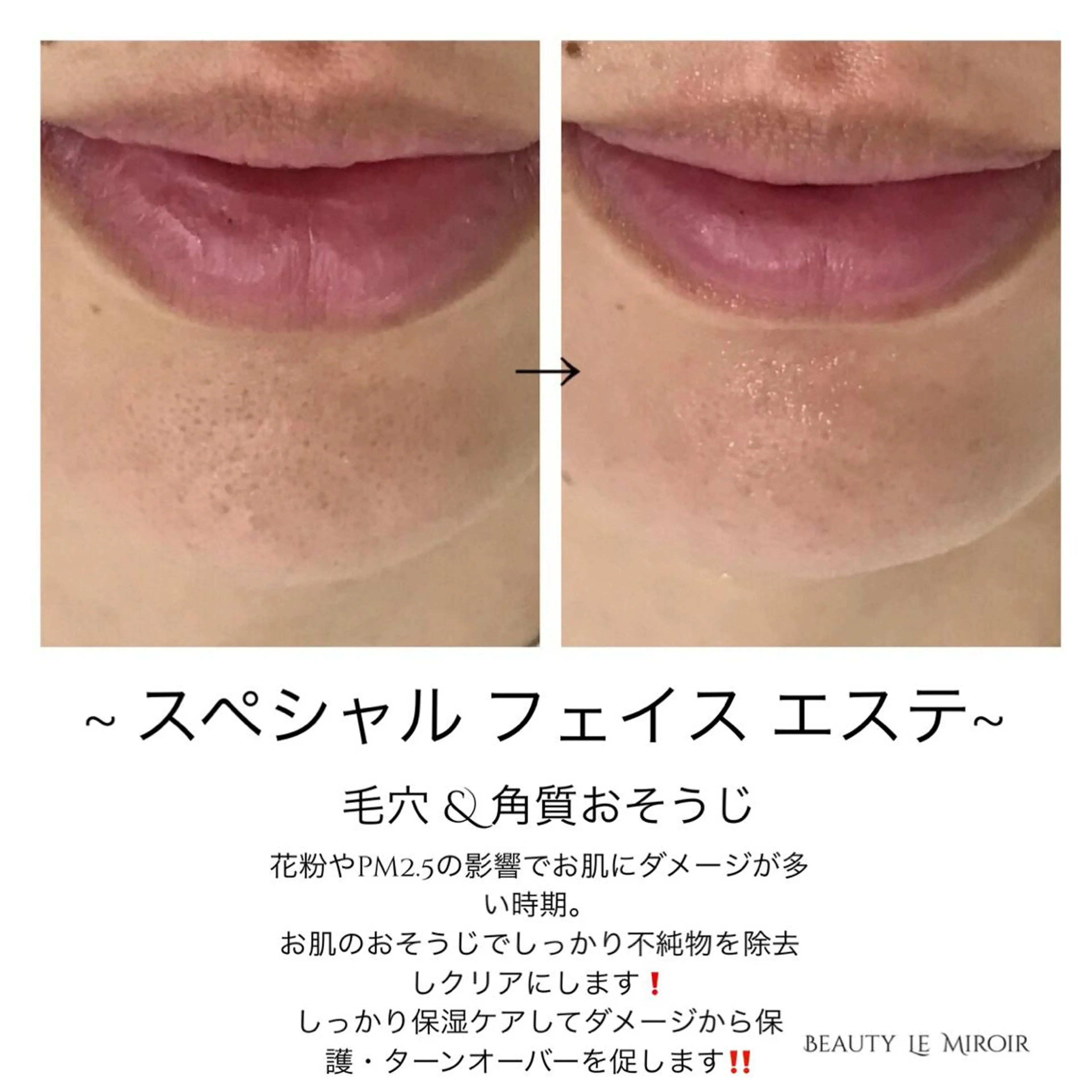 ビューティー ミロワールのエステ・リラクイメージ