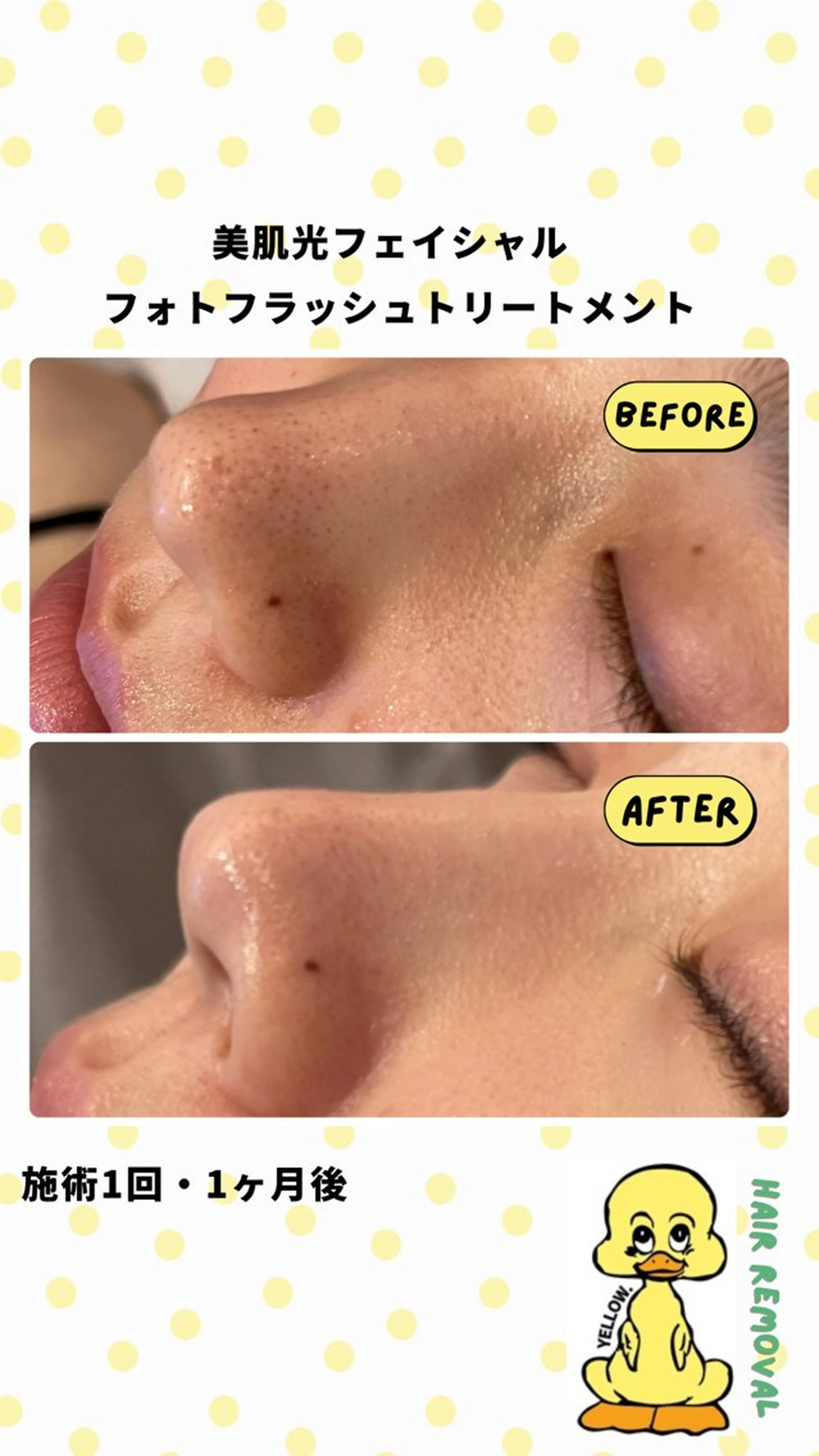 エステ yellow.所属・yellow💛【 脱毛&フェイシャル】のエステ・リラクイメージ