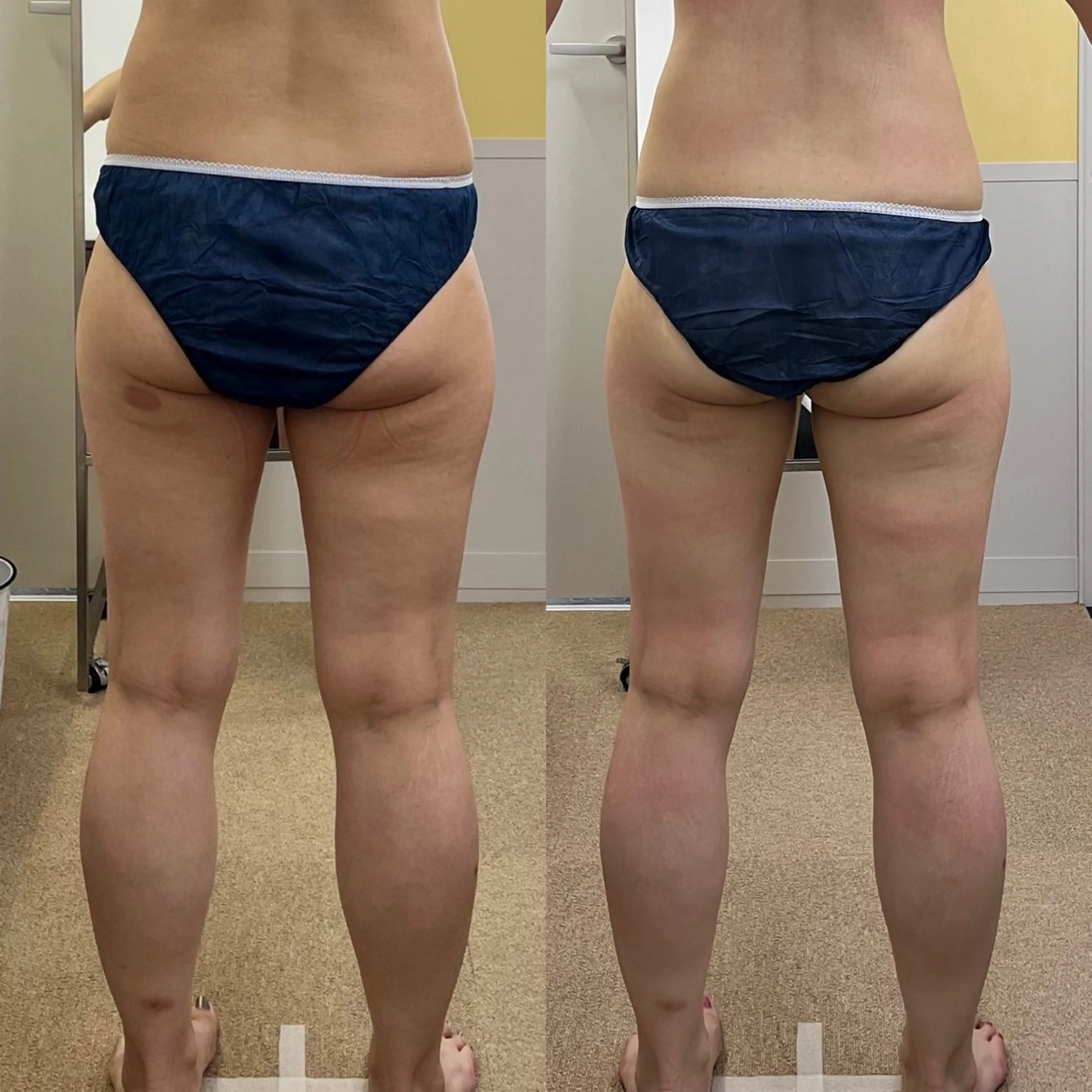 エステ リラク すか ふゆみのマツエク・マツパデザイン