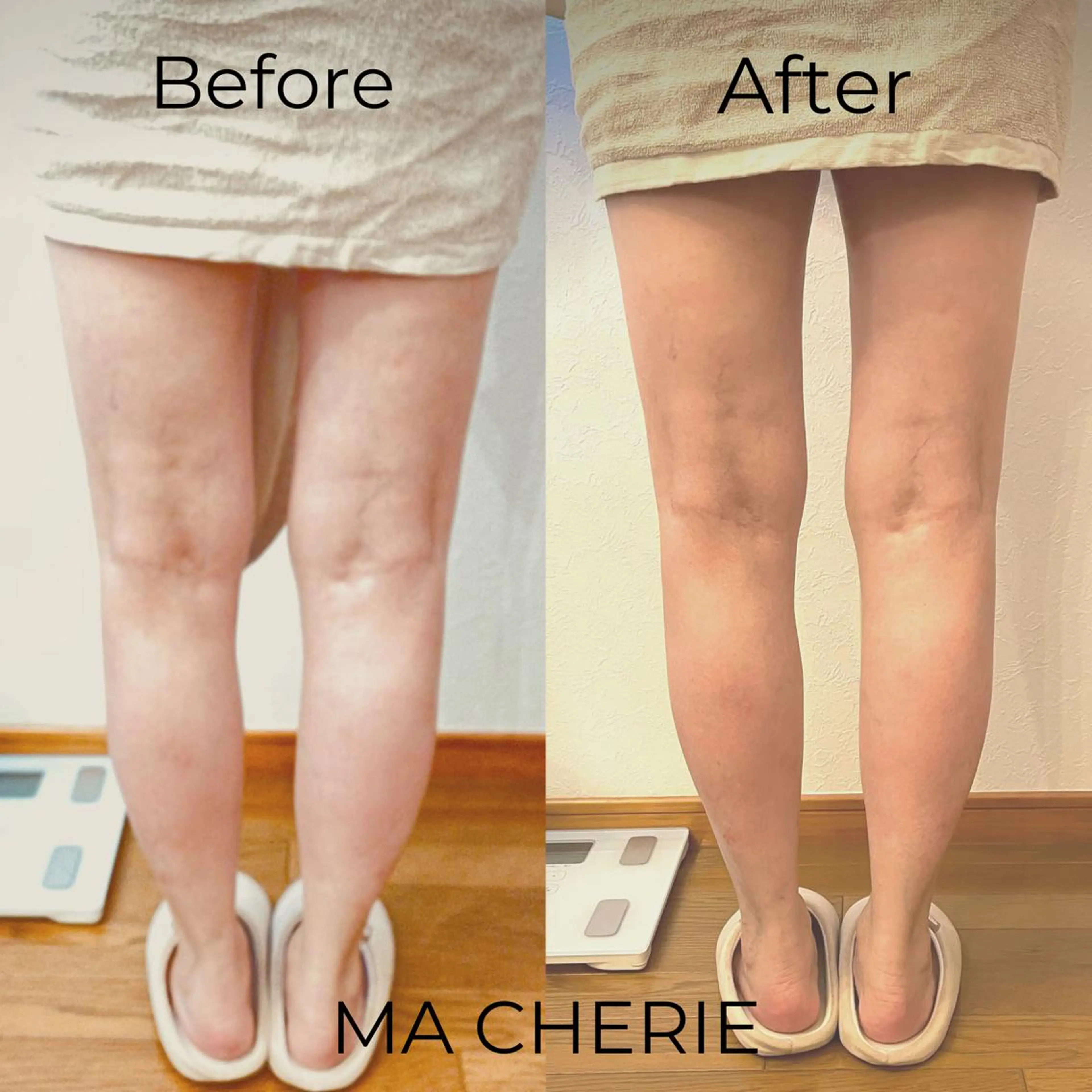 エステ MA CHÉRIE所属・体質別痩身&小顔 MA CHÉRIEのエステ・リラクイメージ