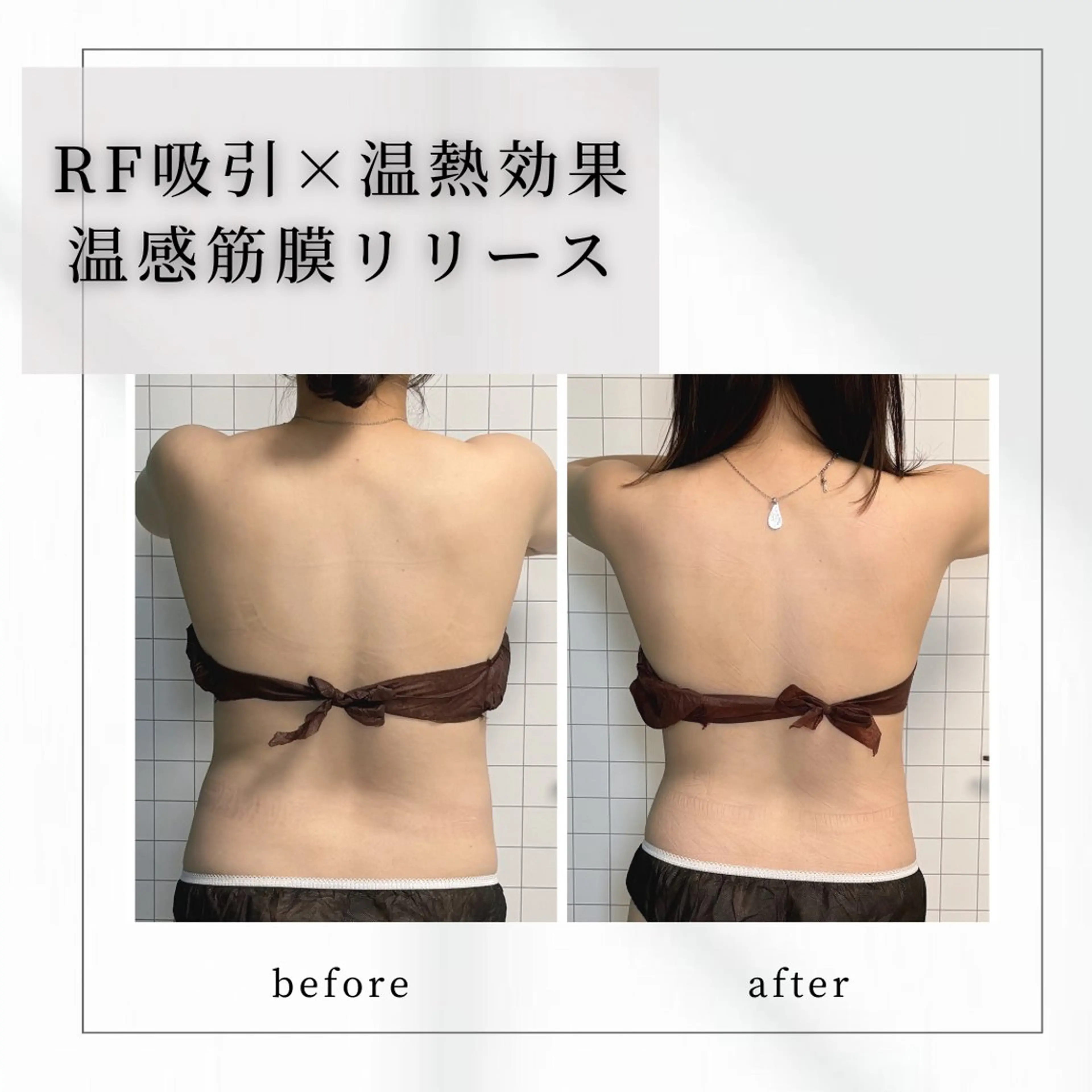 小顔矯正専門店 【RED】池田のエステ・リラクイメージ