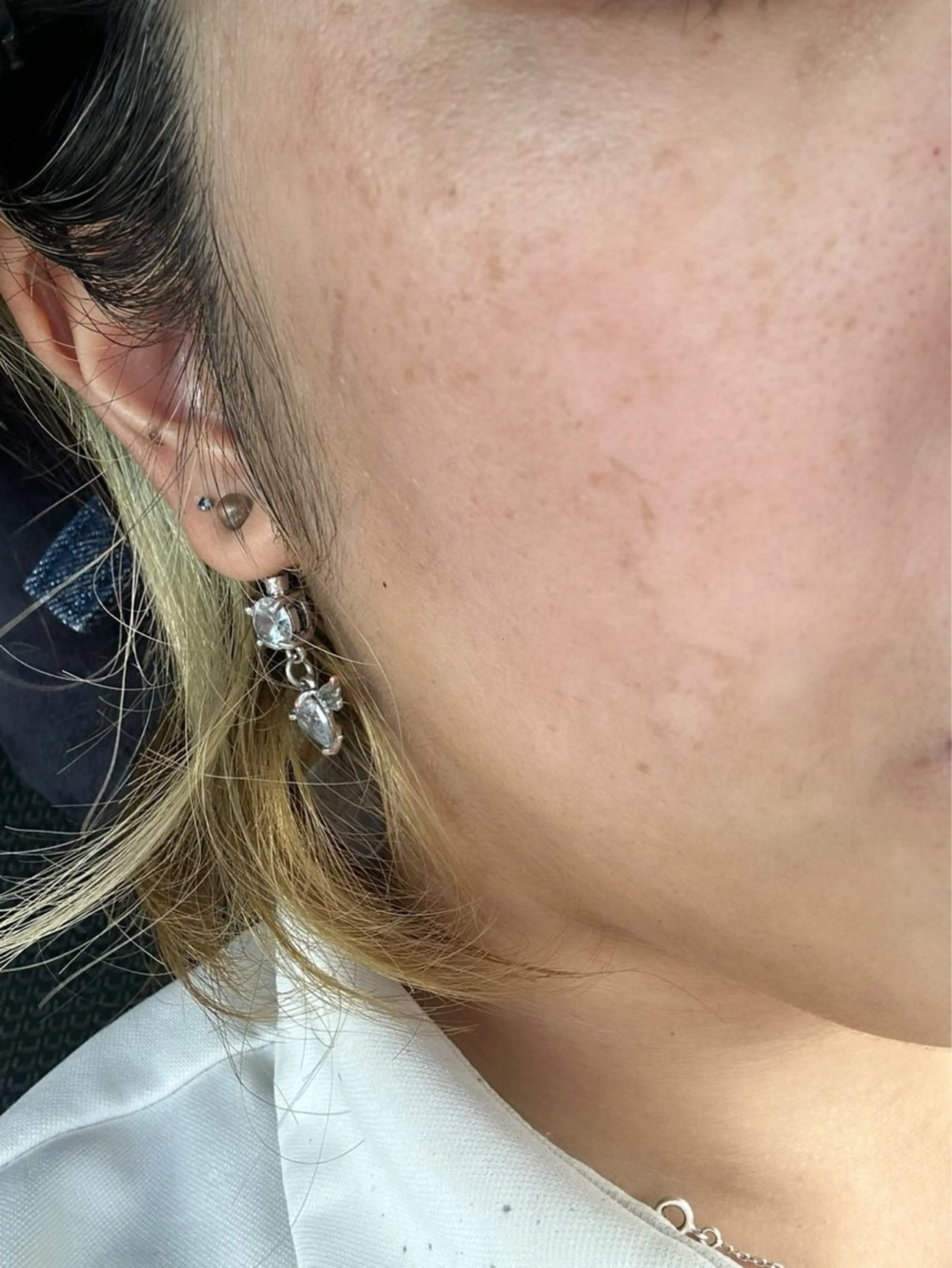 エステ skin make salon -Olu's-所属・毛穴・肌質改善サロン ✨Tomaのその他イメージ