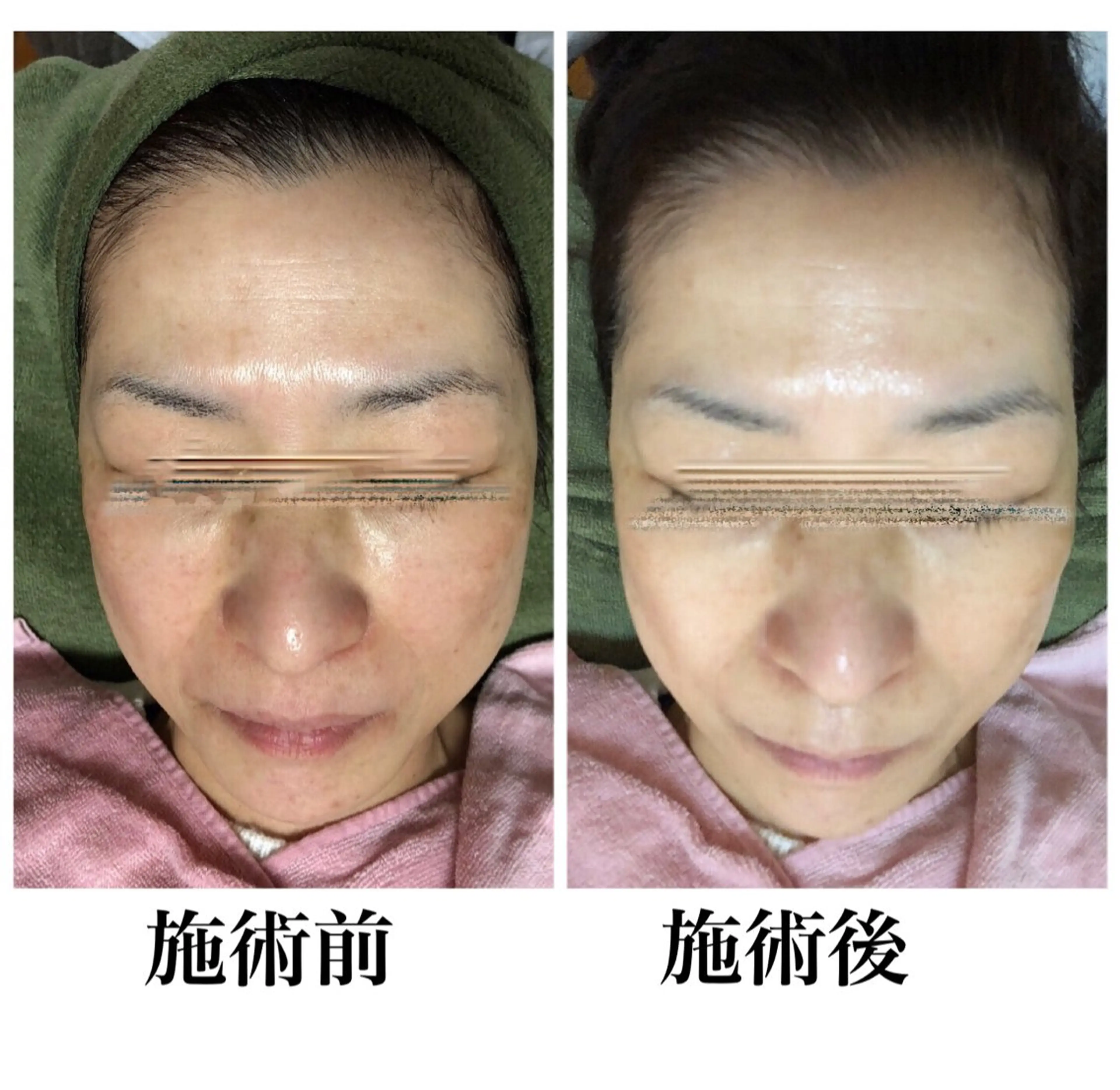 private salon  Dea_maris シュガーリング＆パーソナルボディケア所属・シミ改善・韓国肌管理 ボディメイク痩身のその他イメージ