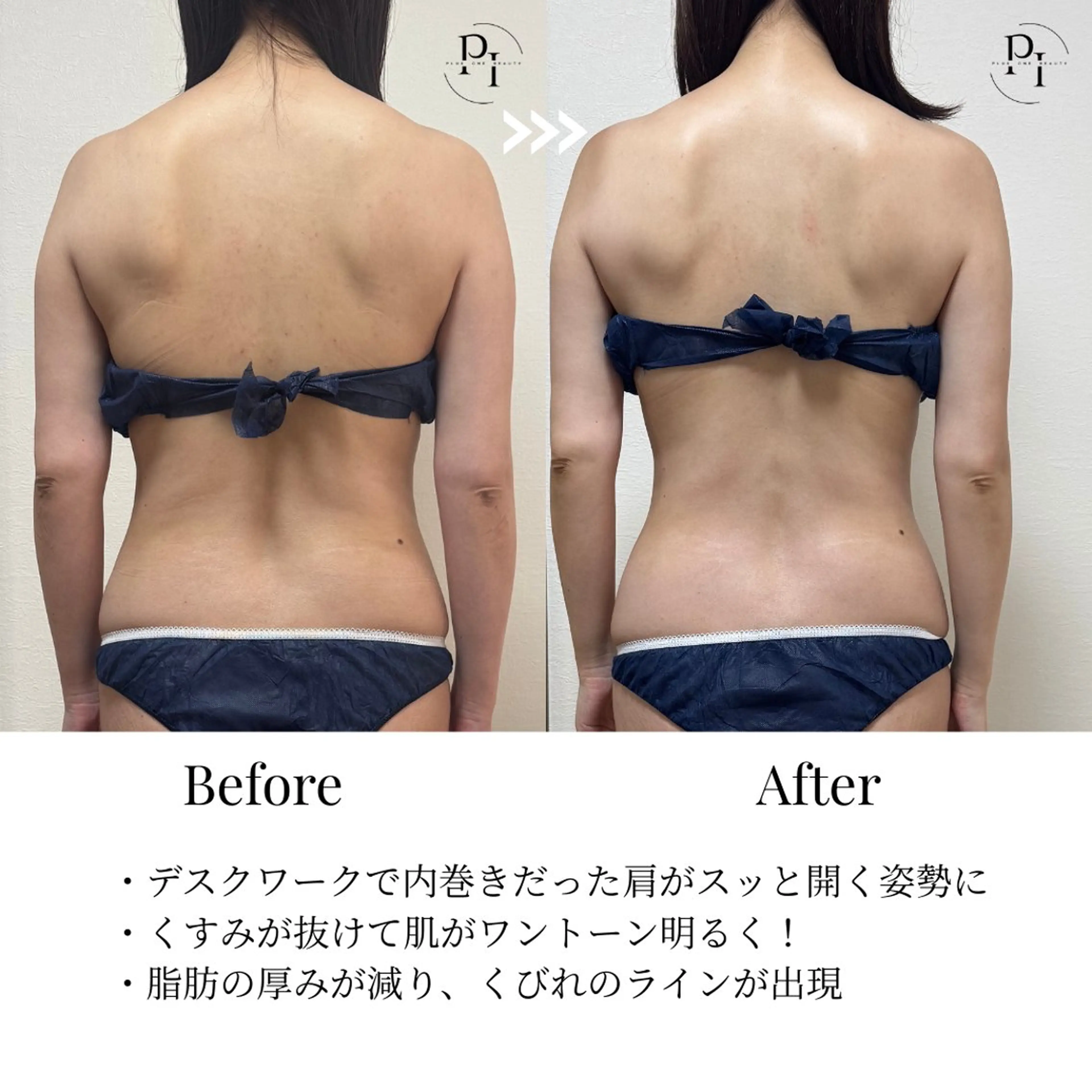 Plus One Beauty所属・【新大阪】痩身/小顔 美肌フェイシャルのエステ・リラクイメージ