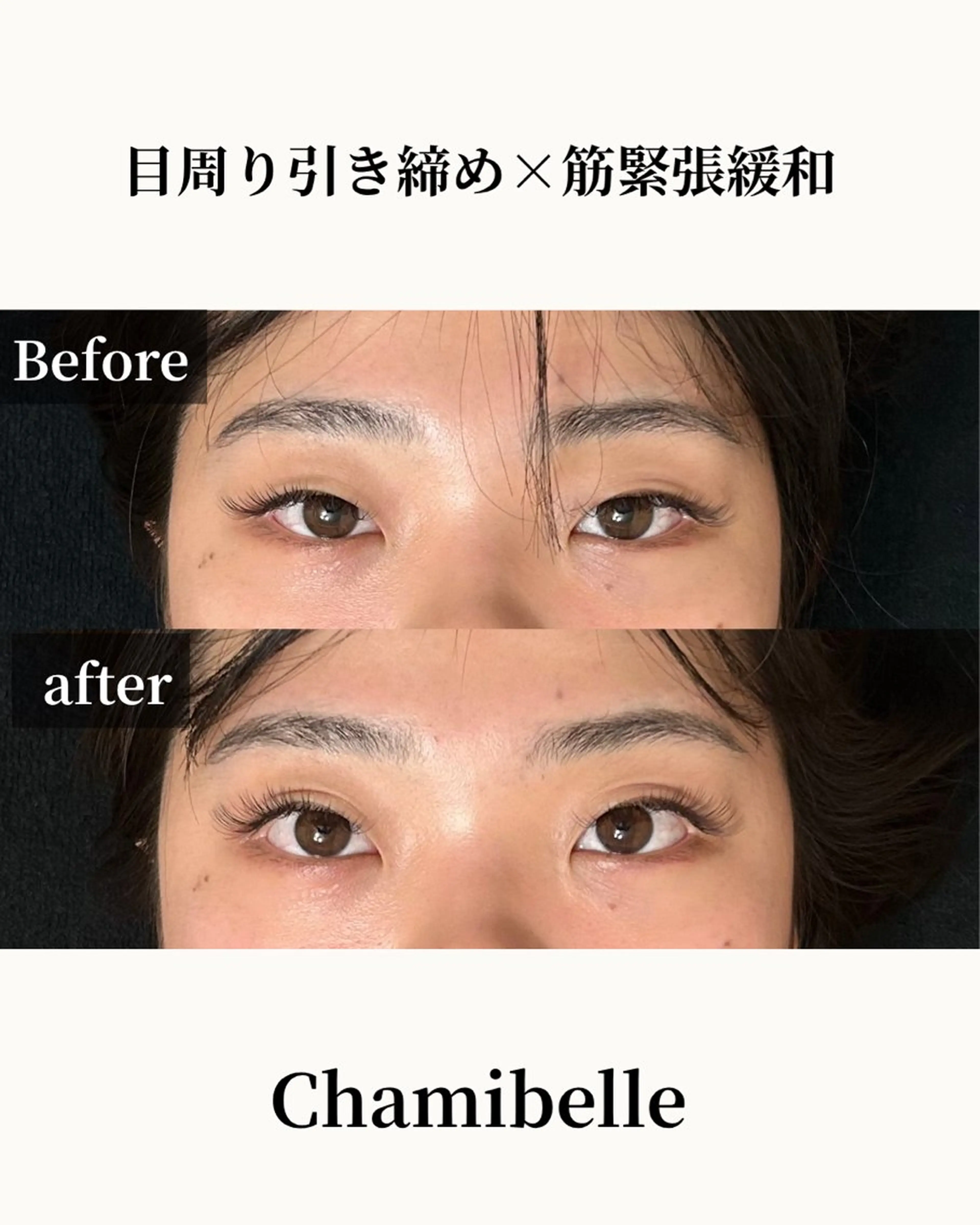 美容鍼灸サロン Chamibelleのエステ・リラクイメージ