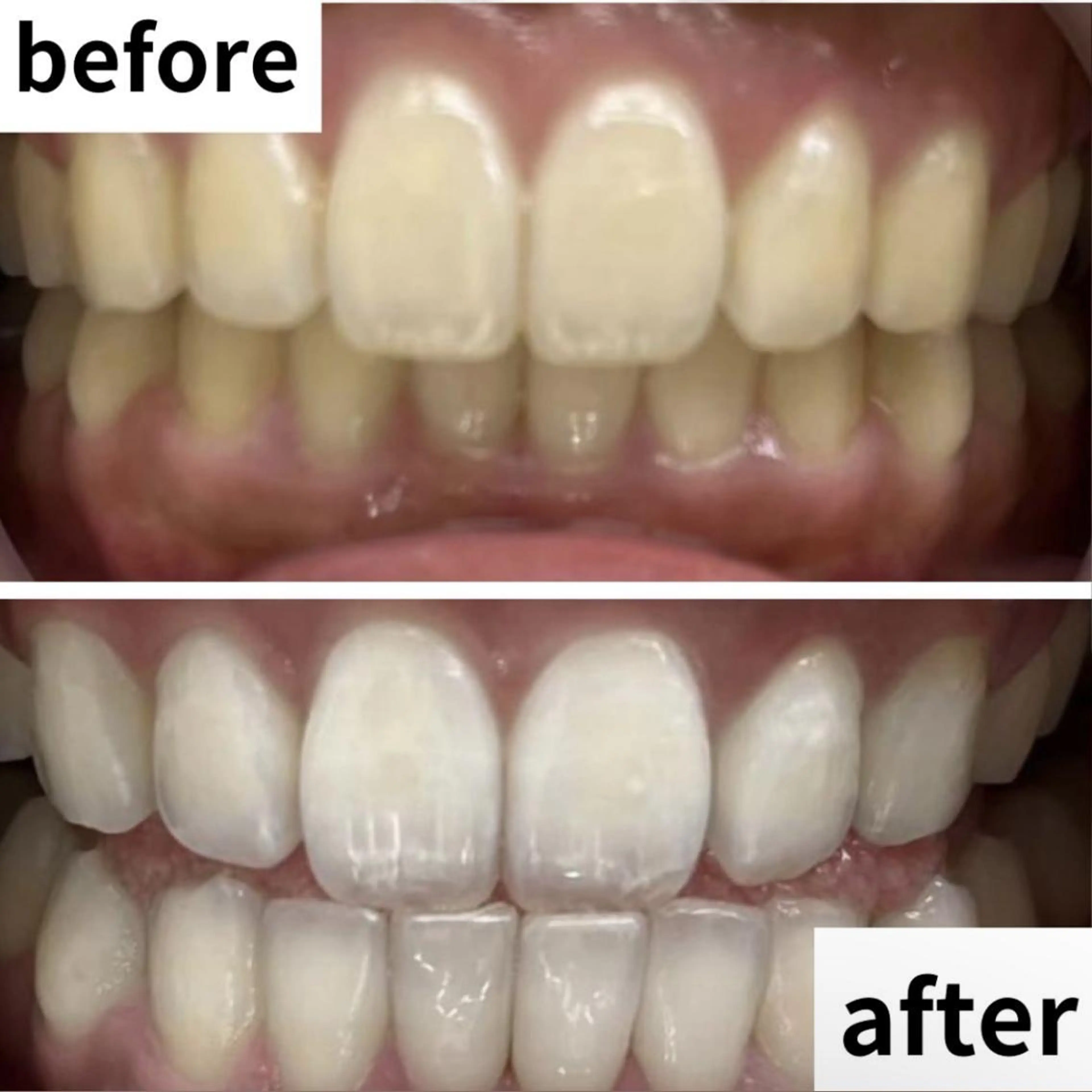 LBSホワイトニング 🌐渋谷店 小河原のエステ・リラクイメージ