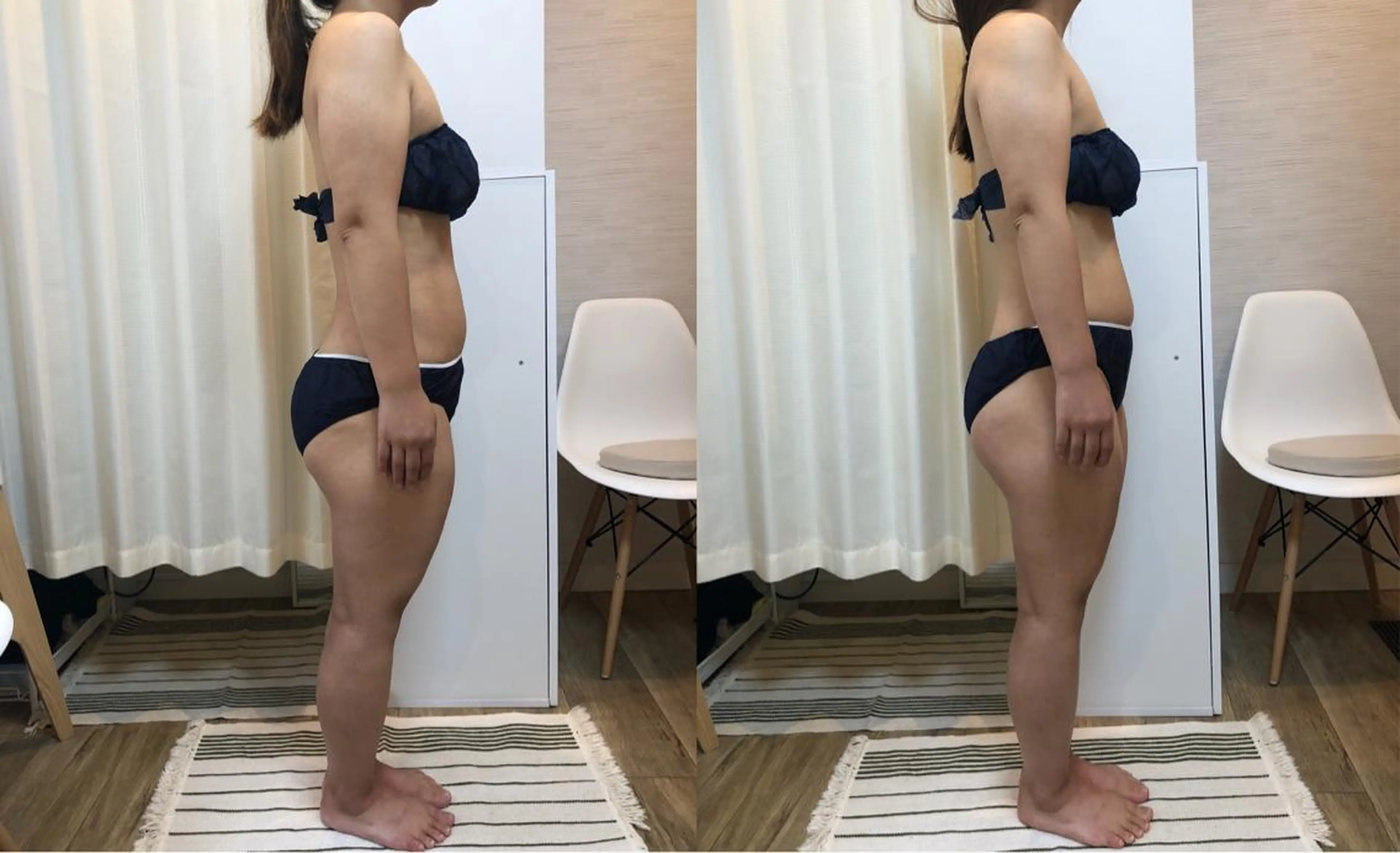 脱毛｜ピーリング ROOM.Sのエステ・リラクイメージ