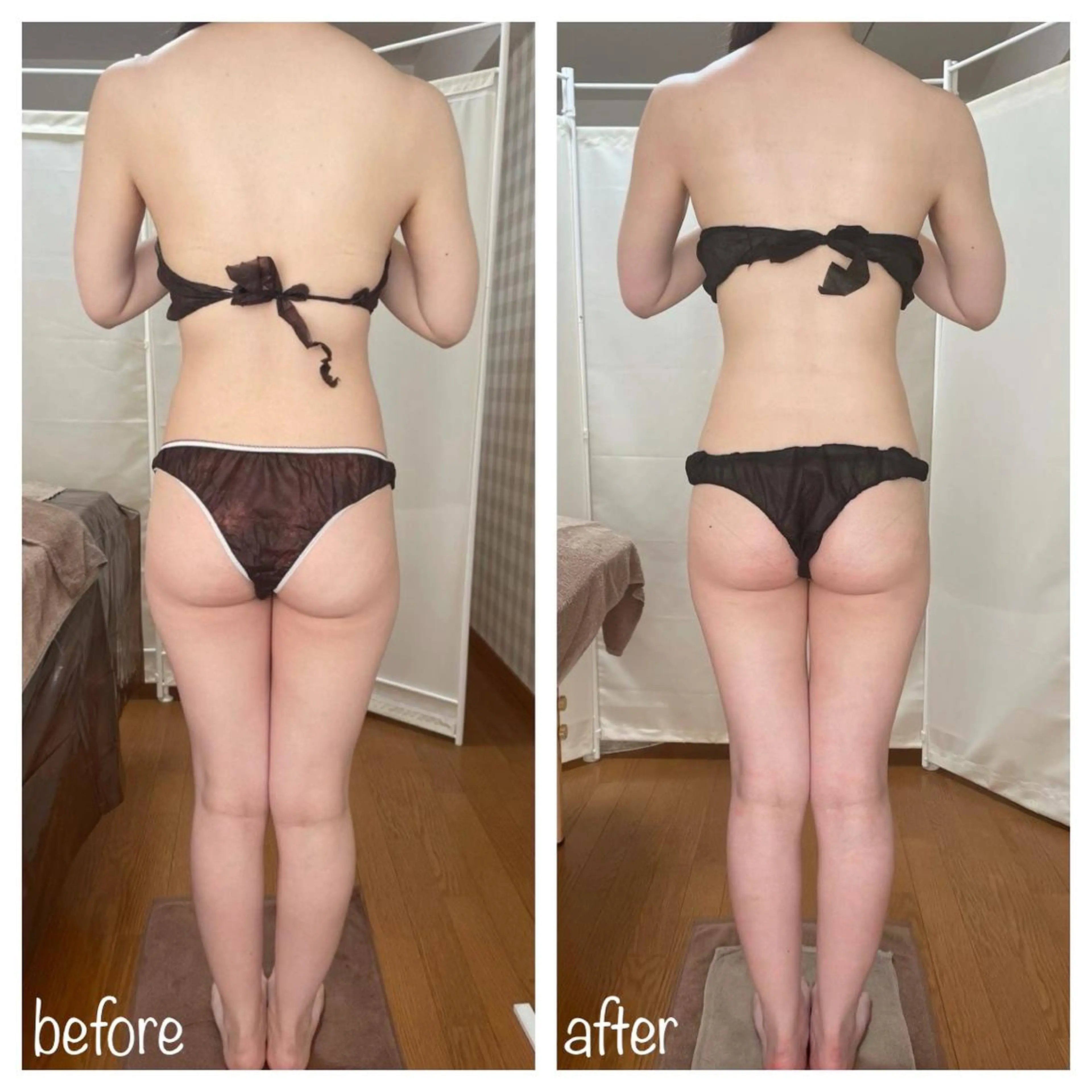 biloop所属・《痩身×疲労改善》 BILOOPのエステ・リラクイメージ