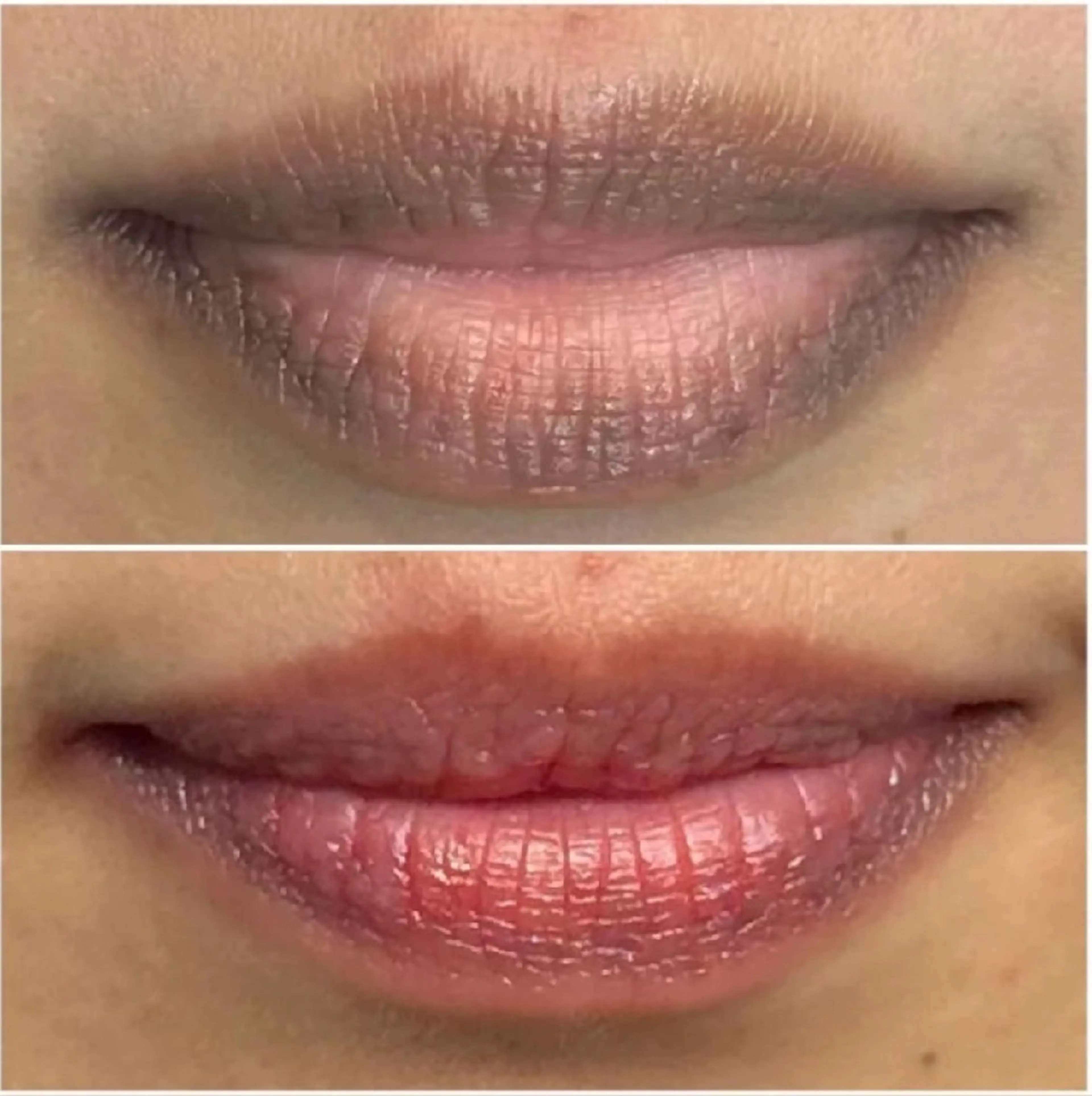 医療提携Ruby所属・医療提携Ruby小顔 ハーブピーリングのその他イメージ