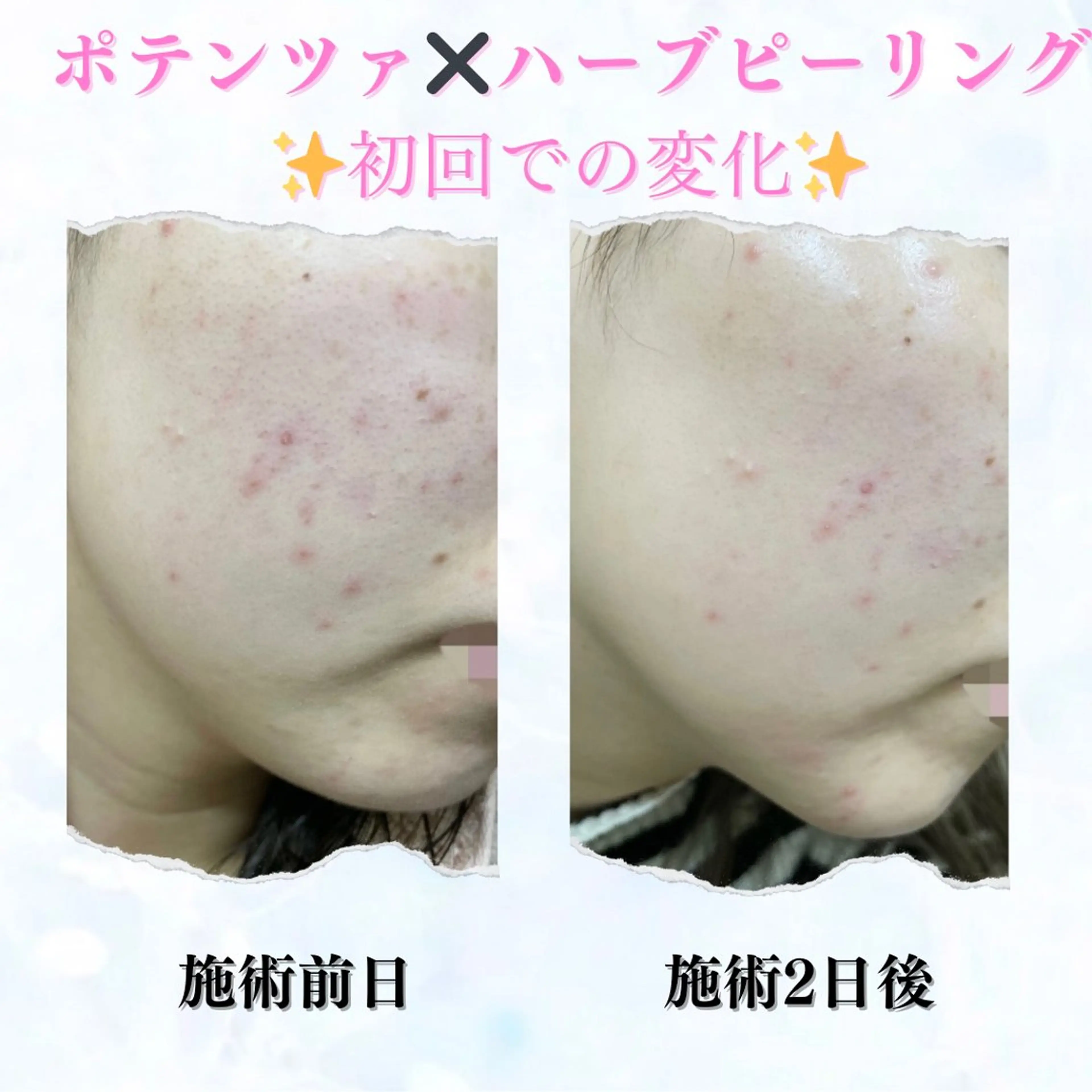 エステ ポテンツァ&針美容 バストアップ専門店のエステ・リラクイメージ