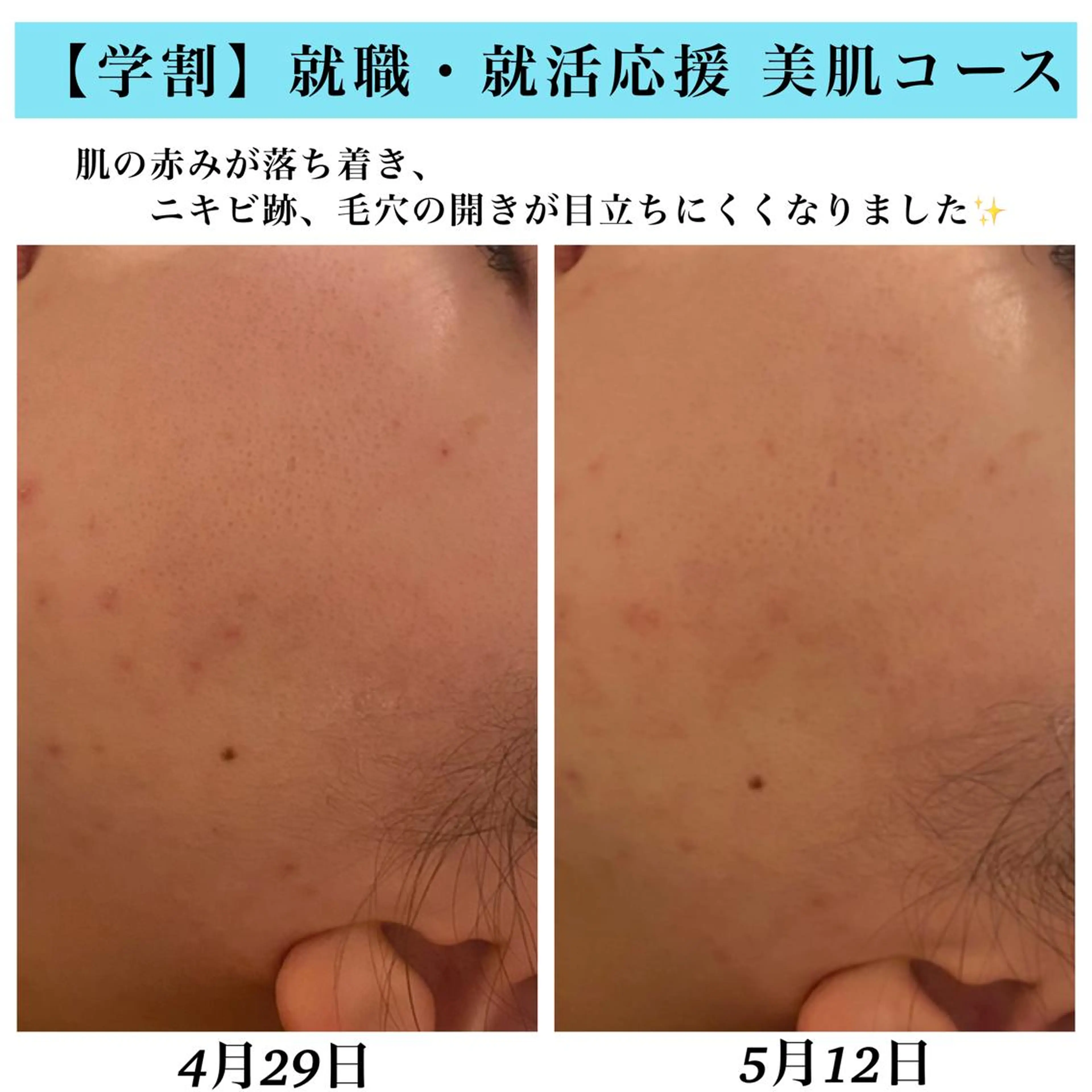 エステ Bellesthe （ベルエステ）のエステ・リラクイメージ