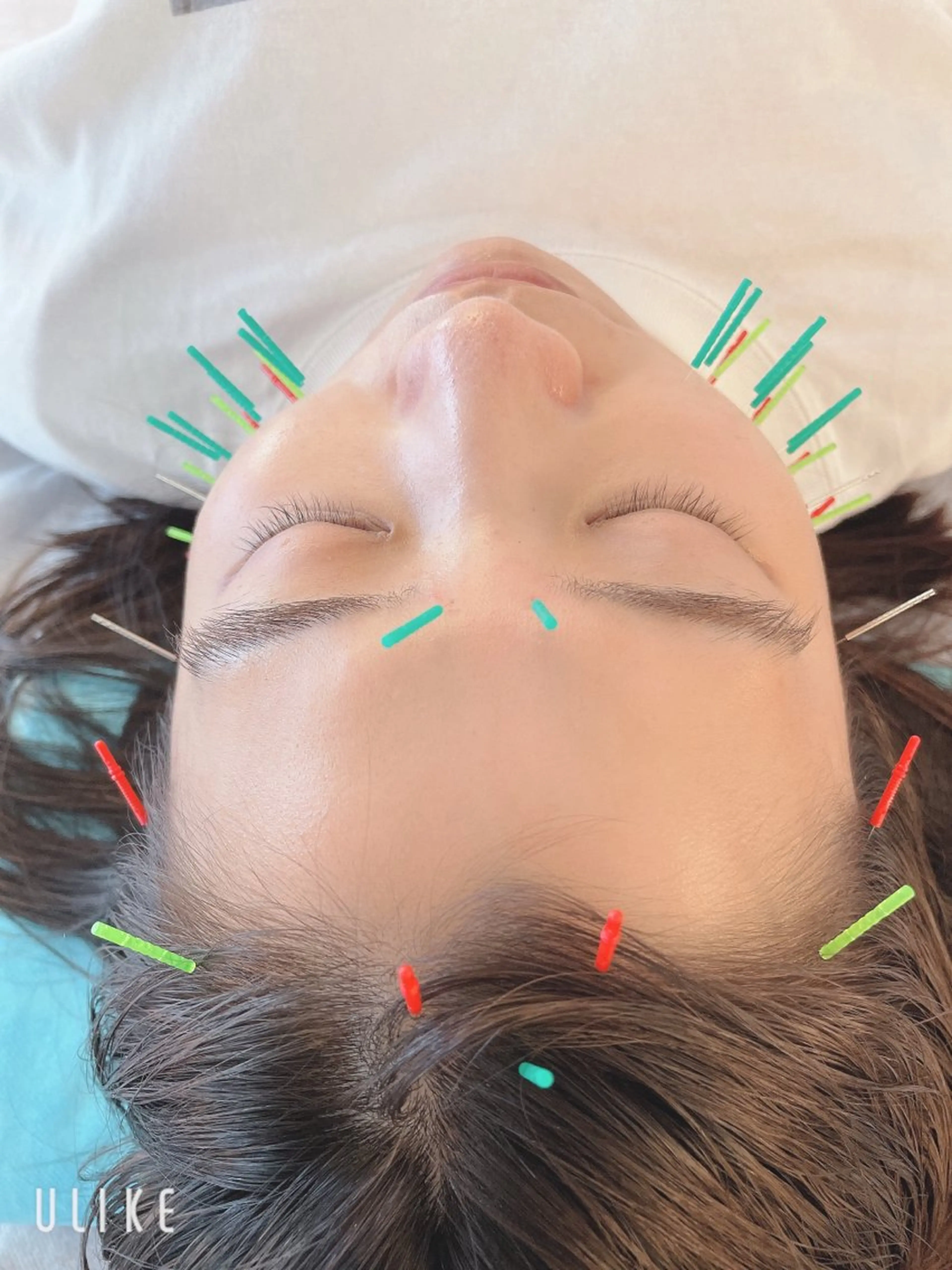 小顔美容鍼専門サロン 渋谷YZのエステ・リラクイメージ