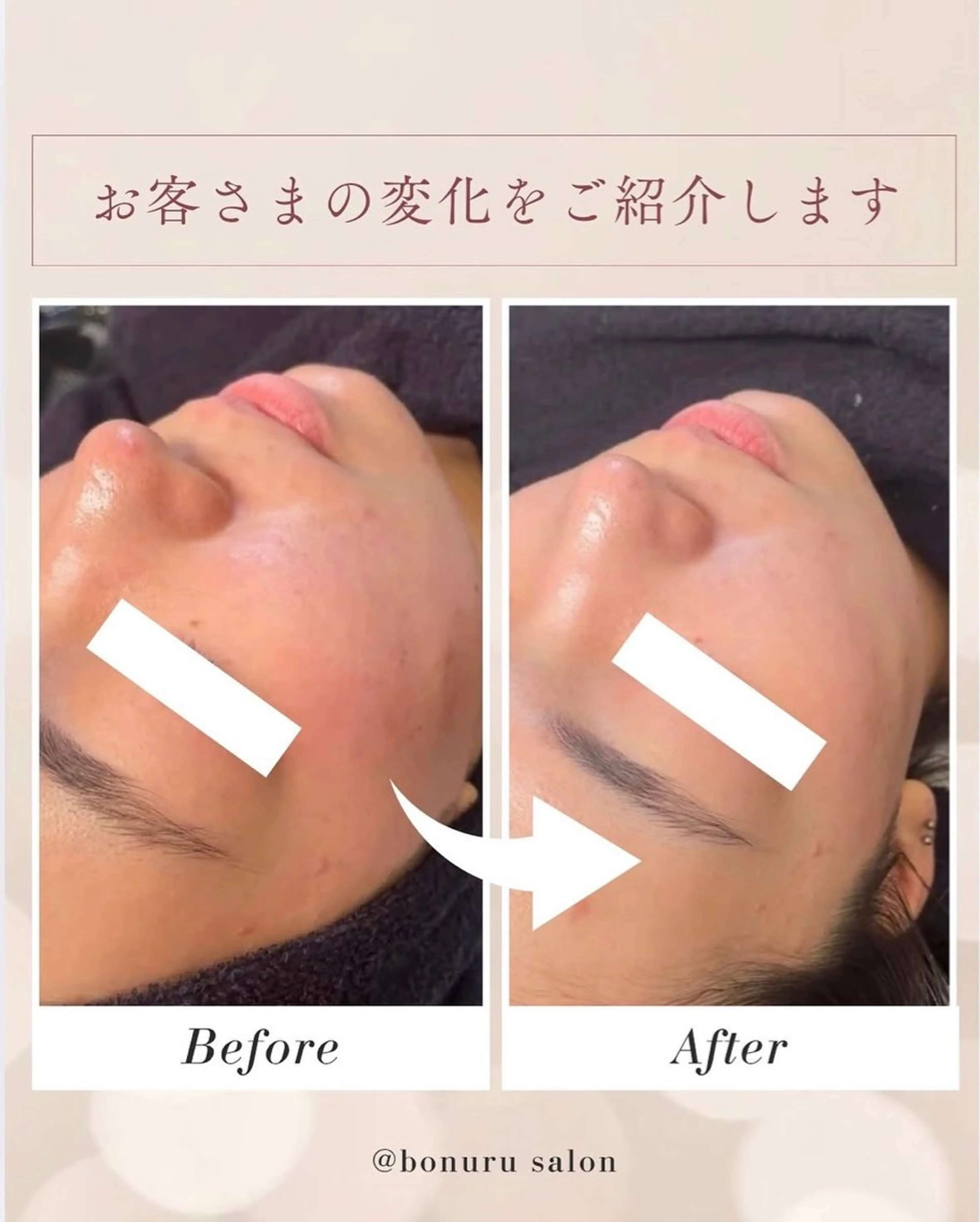 エステ bonuru salonのエステ・リラクイメージ